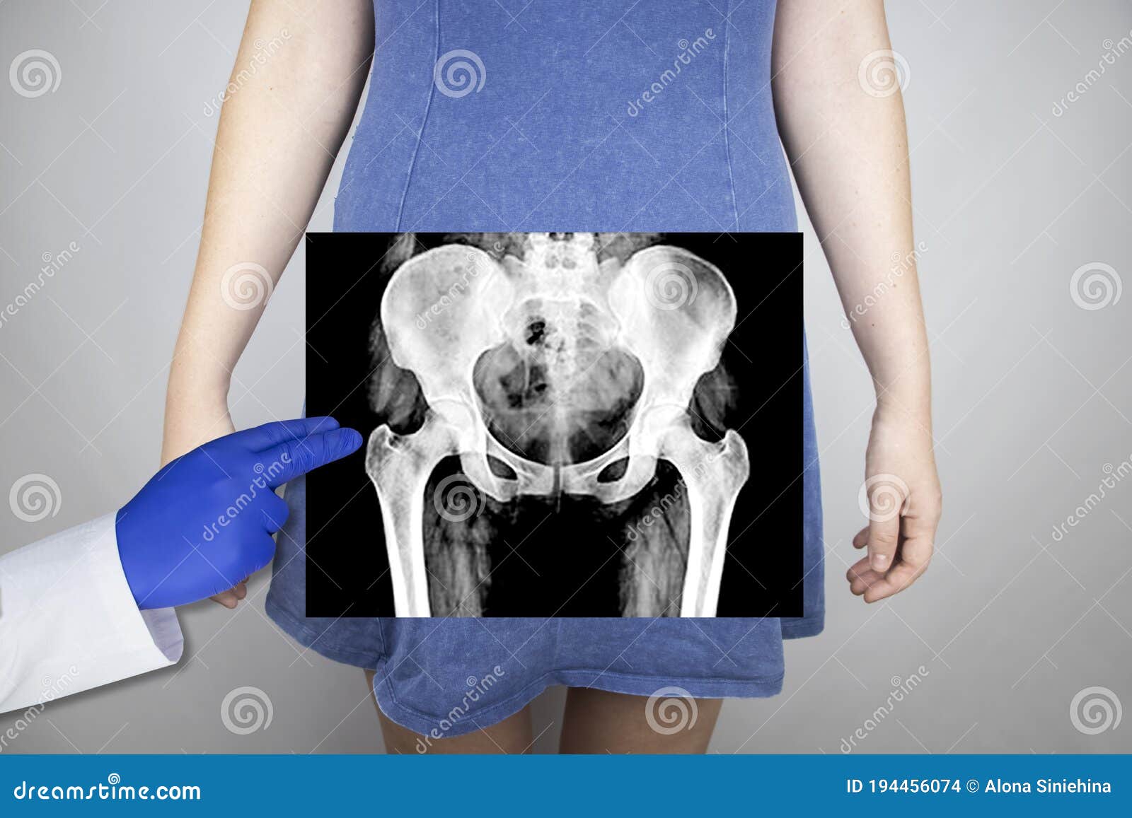 14,000+ Pelvis Anatomy Stock Photos, Pictures & Royalty-Free