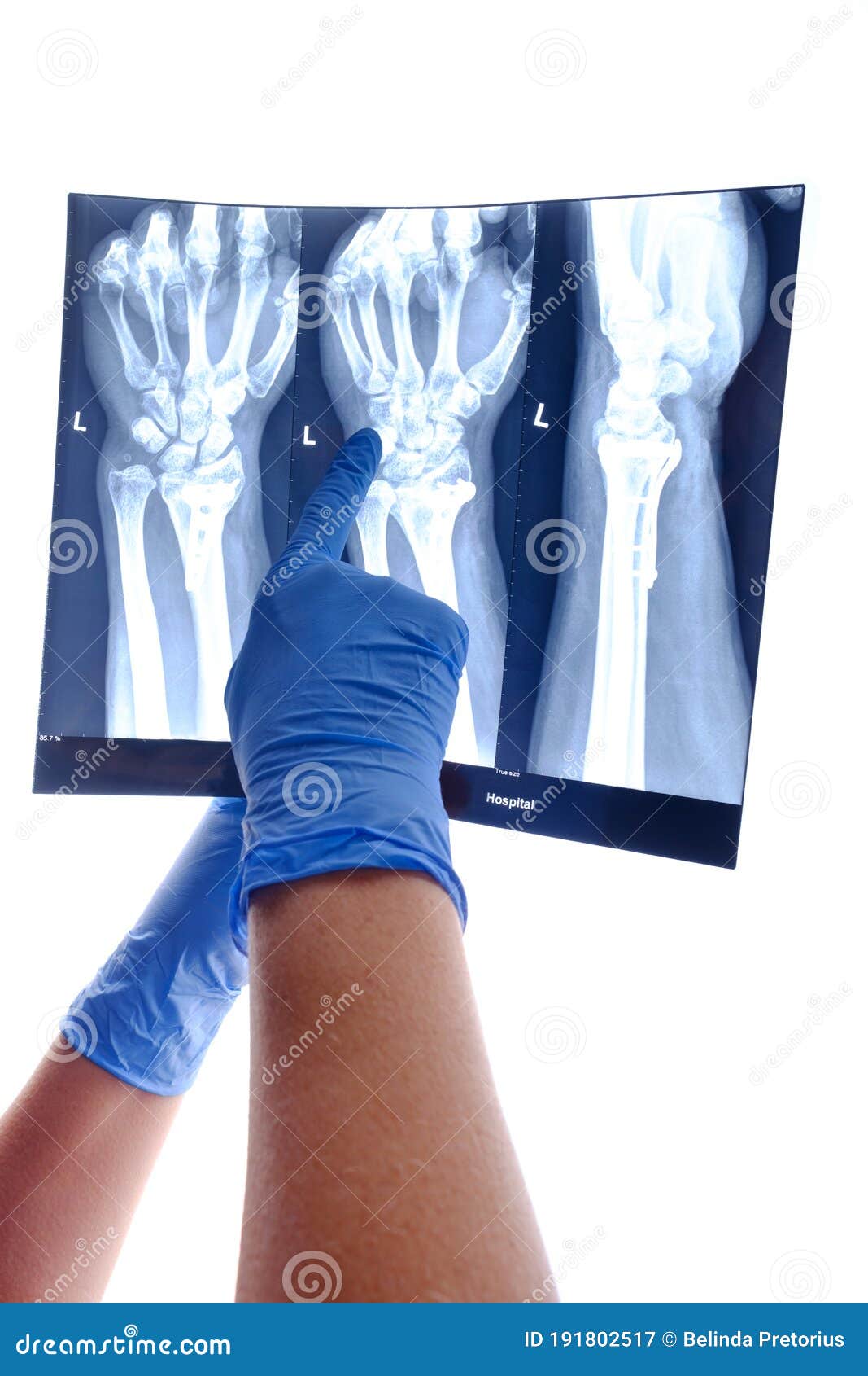 radiologist hands pointing out the results of the correctional surgery