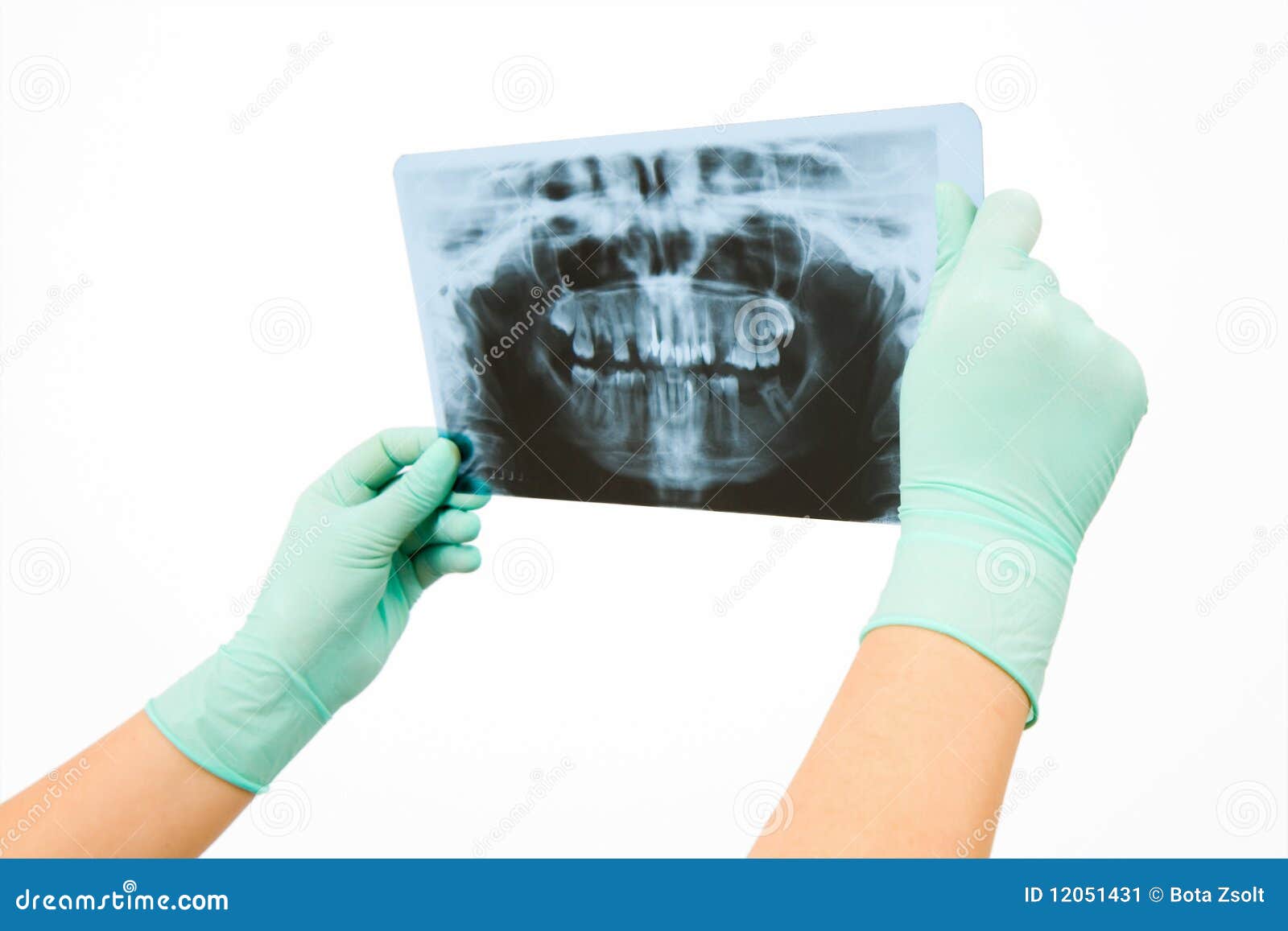 Radiology stock image. Image of hygiene, medical, denture 12051431