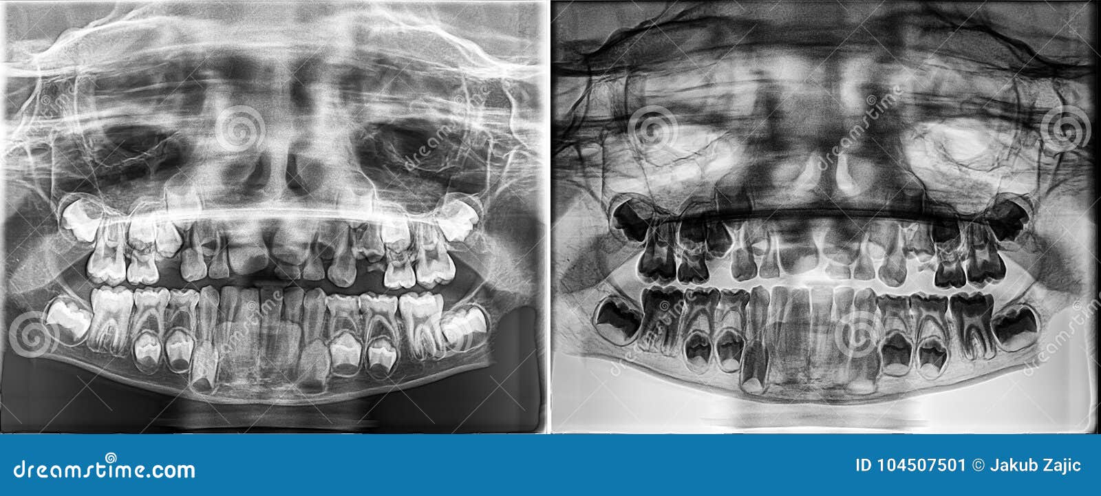 Featured image of post Imagens De Raio X De Dente De Leite / Brasil arrisca virar uma imensa manaus.