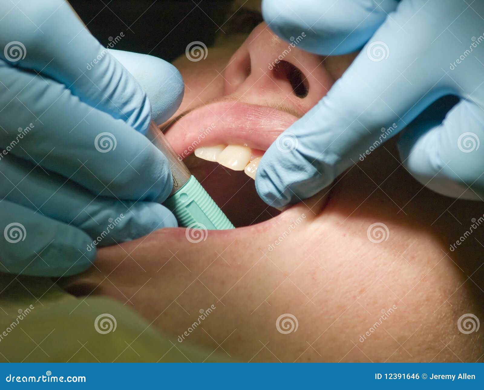 Raum-Check. Eine Nahaufnahme eines zahnmedizinischen hygenist, das die Zähne eines Patienten auf caivties überprüft.