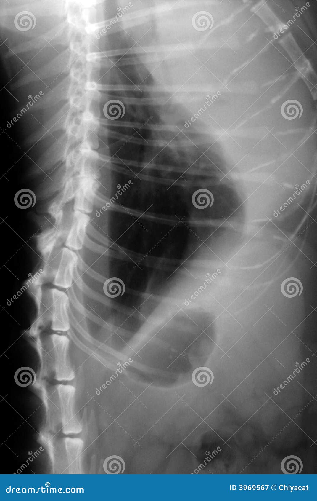 Chat De Thorax De Rayon X Photos Libres De Droits Et Gratuites De Dreamstime