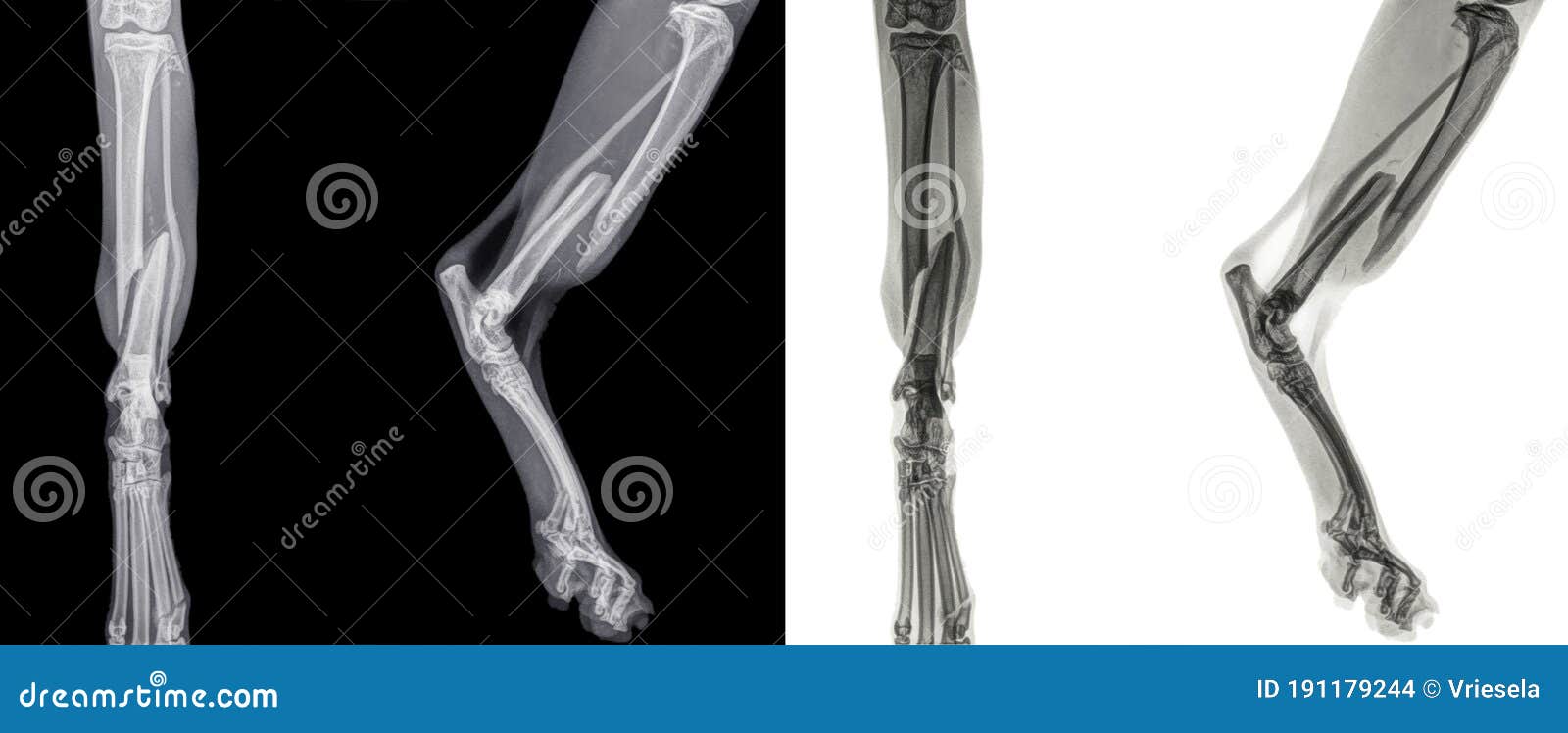 Rayons X De La Patte De Derriere D Un Chat Avec Une Fracture Du Tibia De Shinbone Photo Stock Image Du Felin Inspection Rayons X De La Patte De Derriere D Un Chat Avec Une Fracture Du Tibia De Shinbone Photo Stock Image Du Felin Inspection