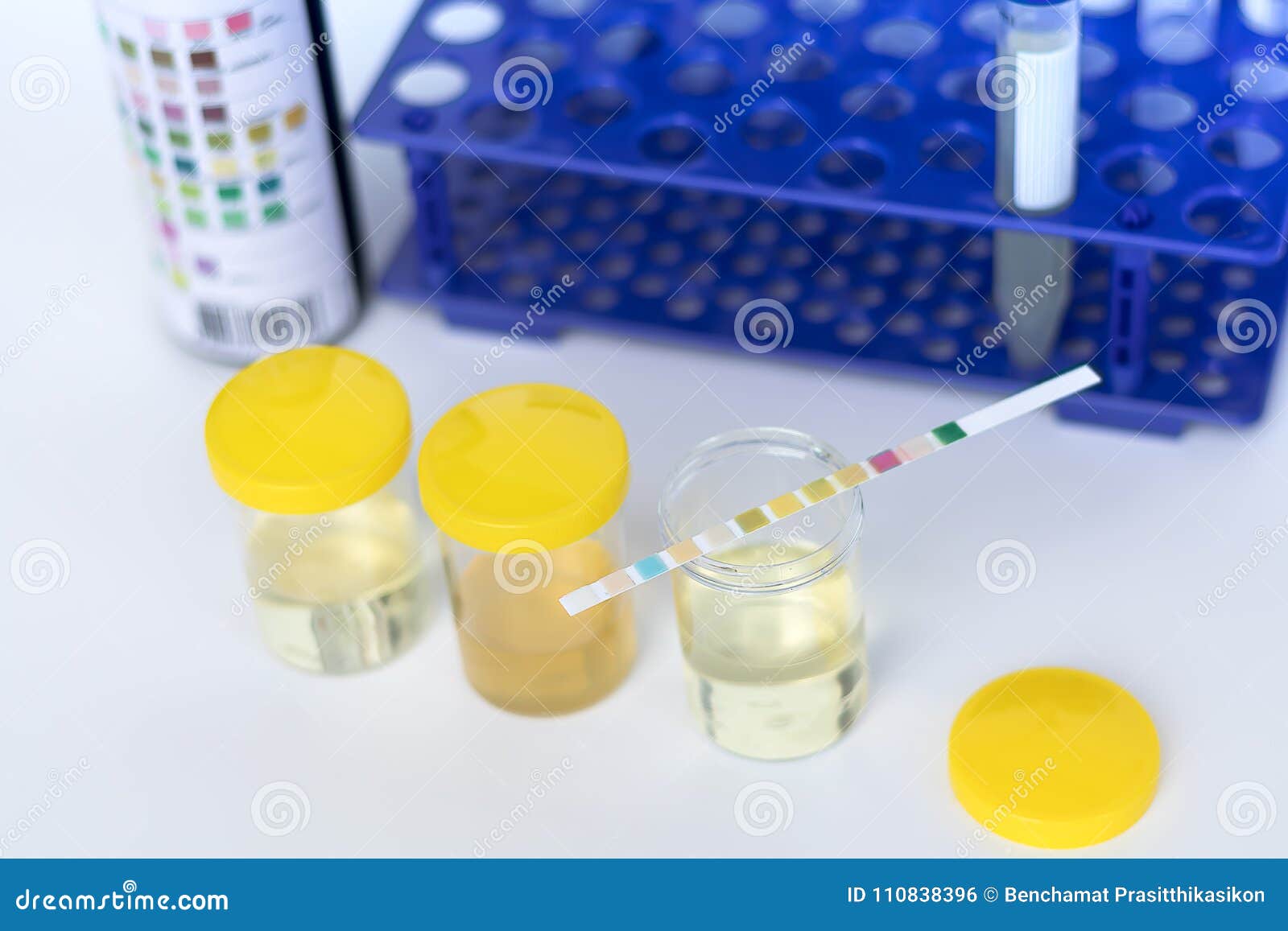 Reagent Strip Test Urinalysis In Laboratory Stock Image CartoonDealer reagent-strip-test-urinalysis-in-laboratory-stock-image-cartoondealer
