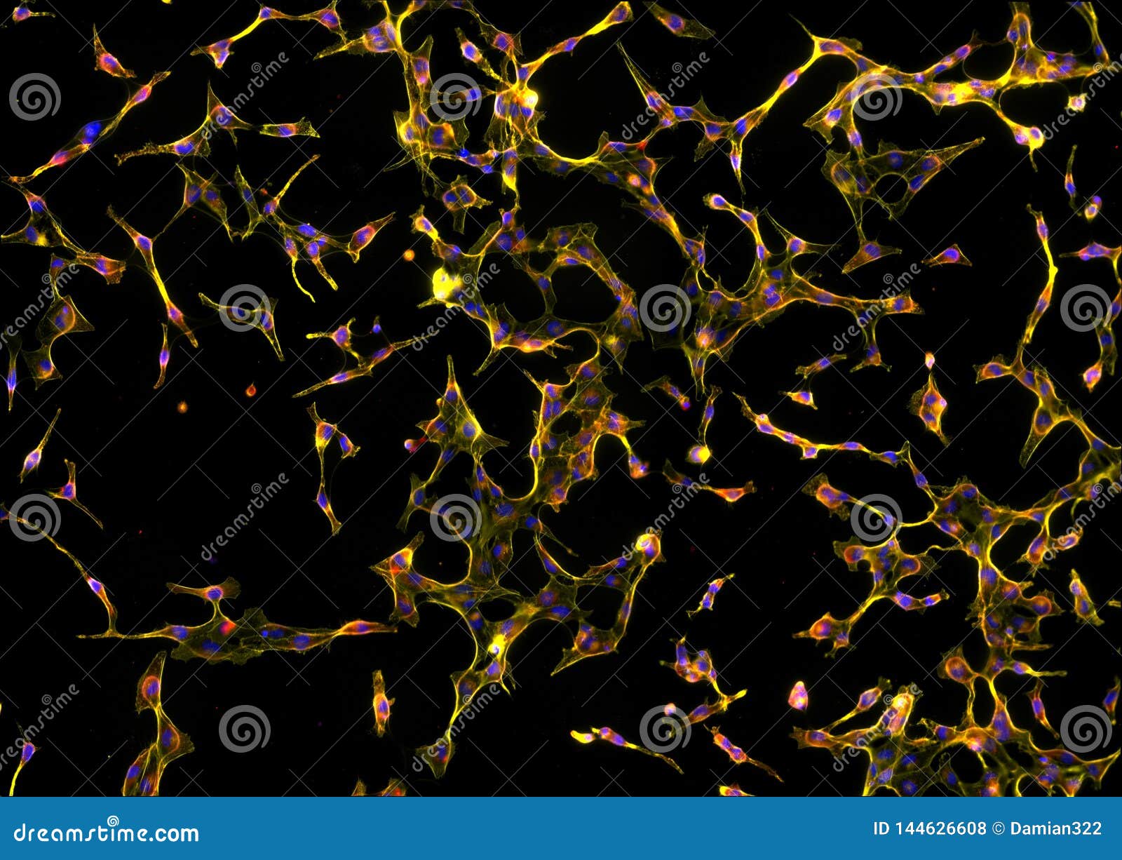 real fluorescence microscopic view of human fibroblasts