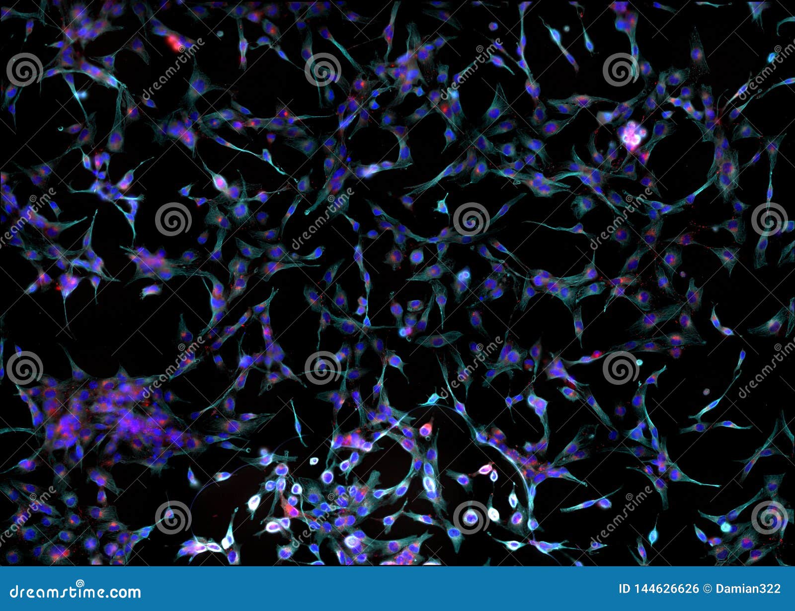 real fluorescence microscopic view of human fibroblasts