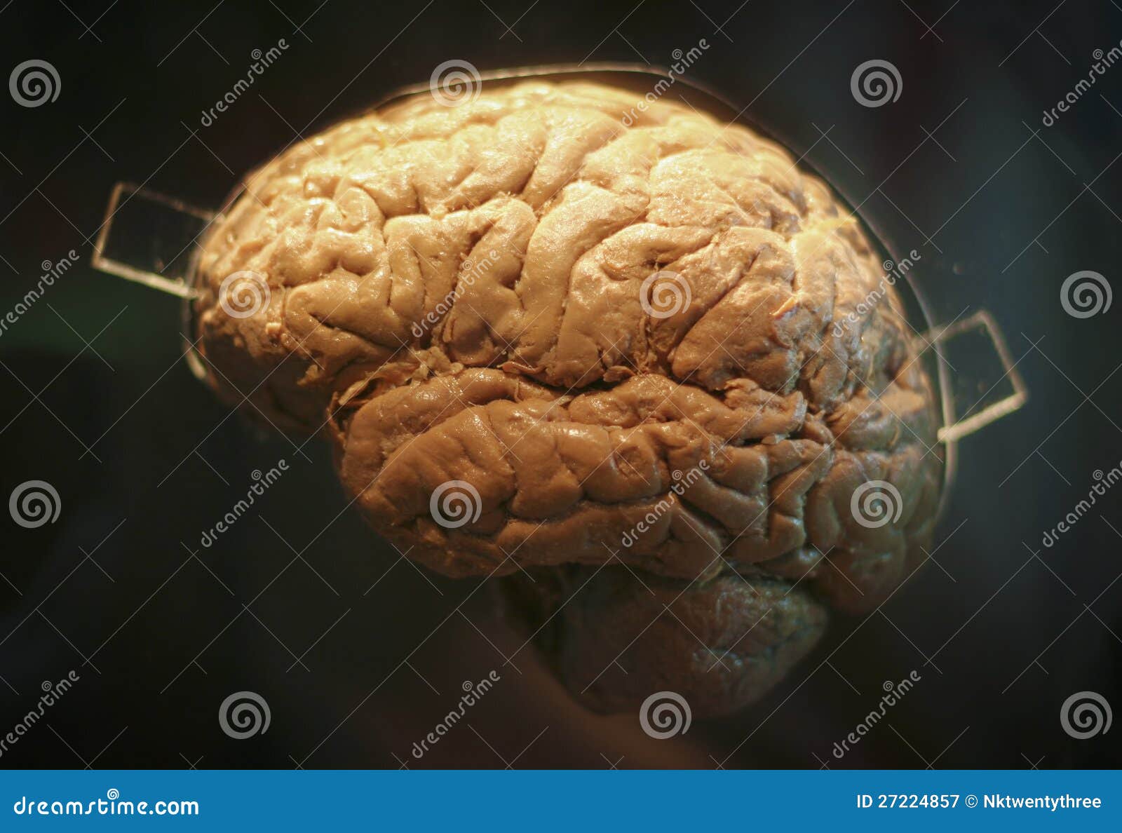 Real Human Brain Stock Image Image Of Brains Health 27224857
