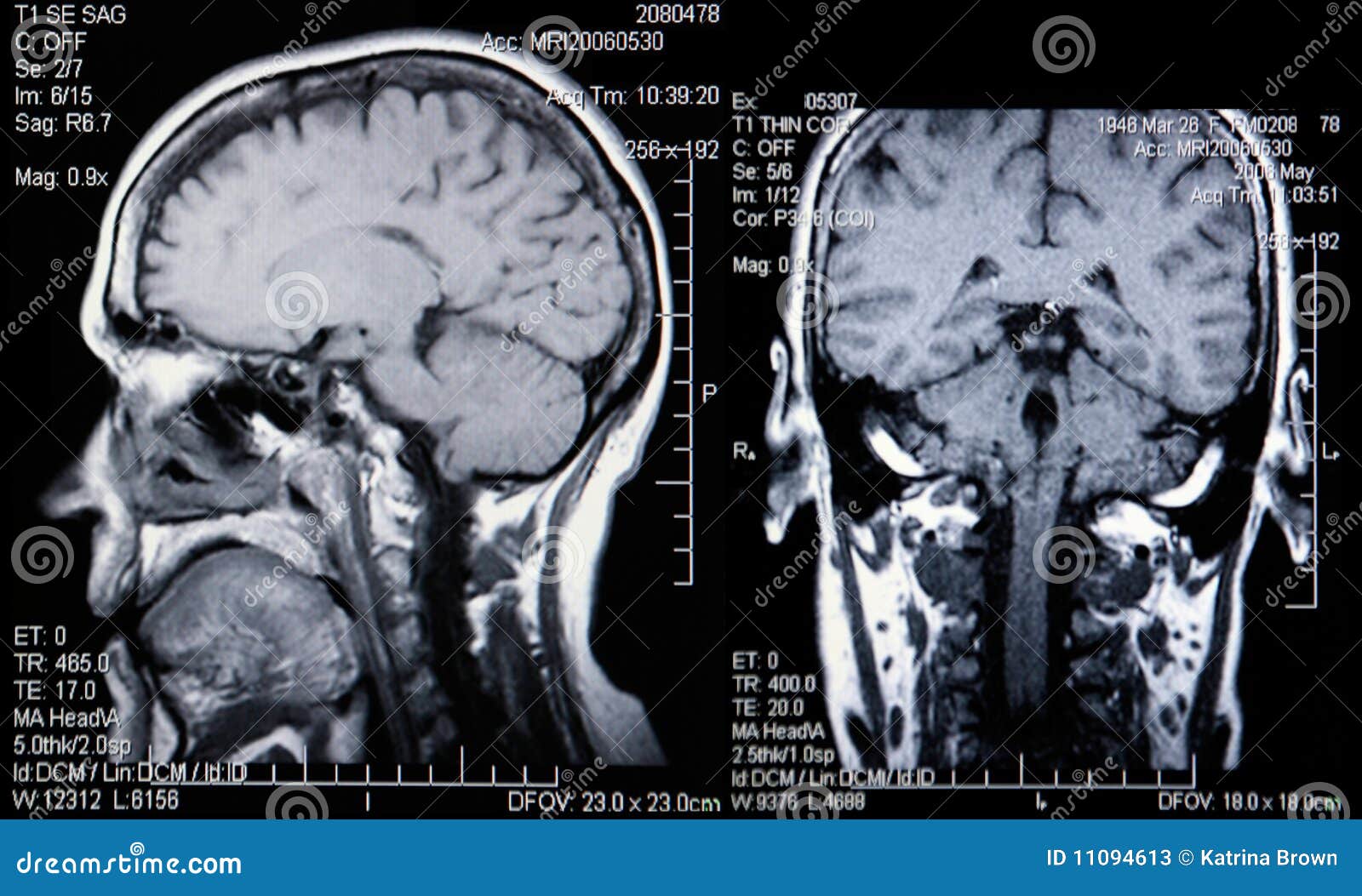 brain of parts 9 the Brain And Image Of Stock MRI Scans Image Head The Real brain of parts 9 the Brain And Image Of Stock MRI Scans Image Head The Real