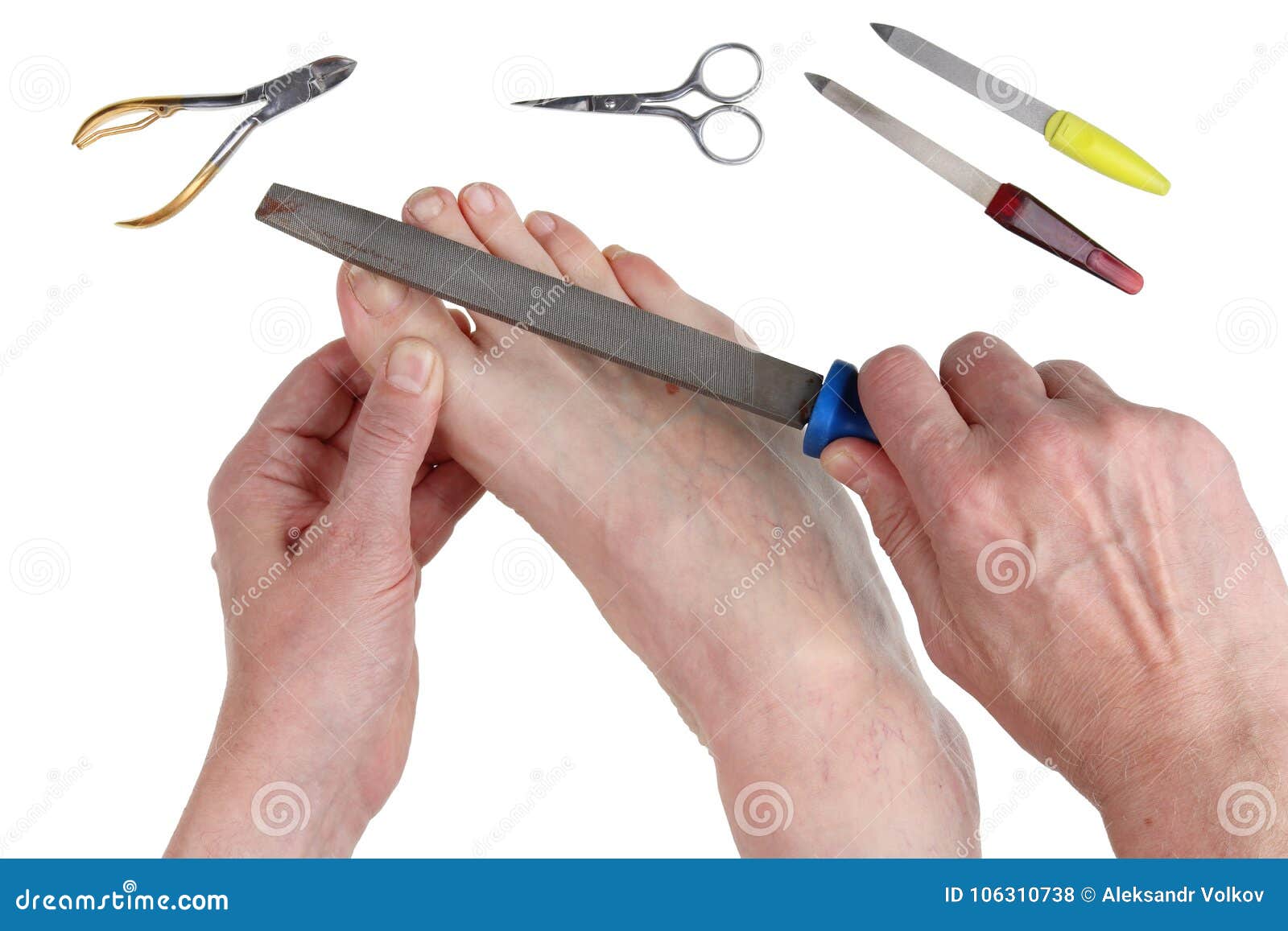 Real Problems with Leg Nails in Older Men Can Be Solved with a C Stock Photo - Image of nail