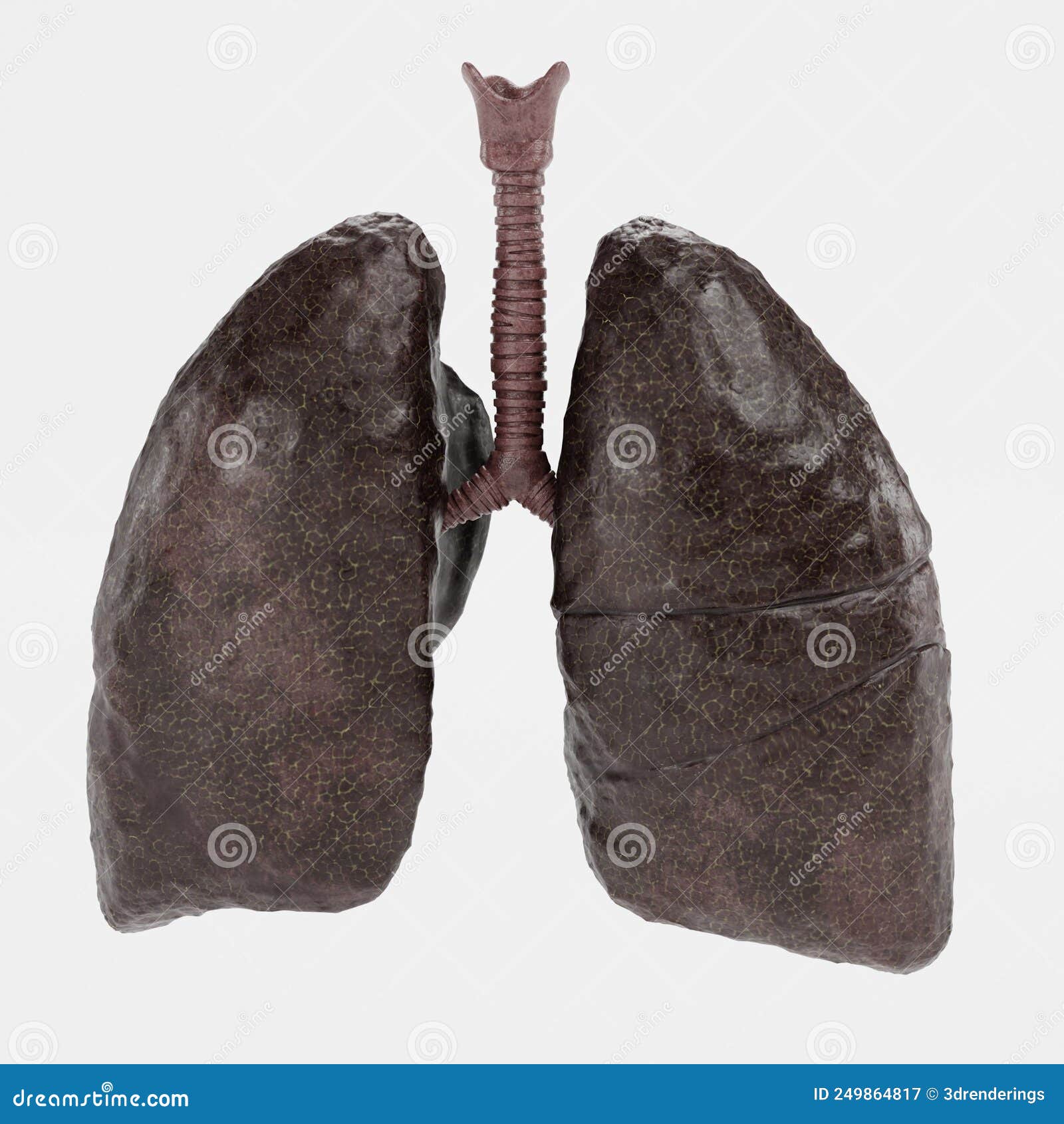 Smoker Vs Nonsmoker Lungs Anatomy Stock Photography CartoonDealer