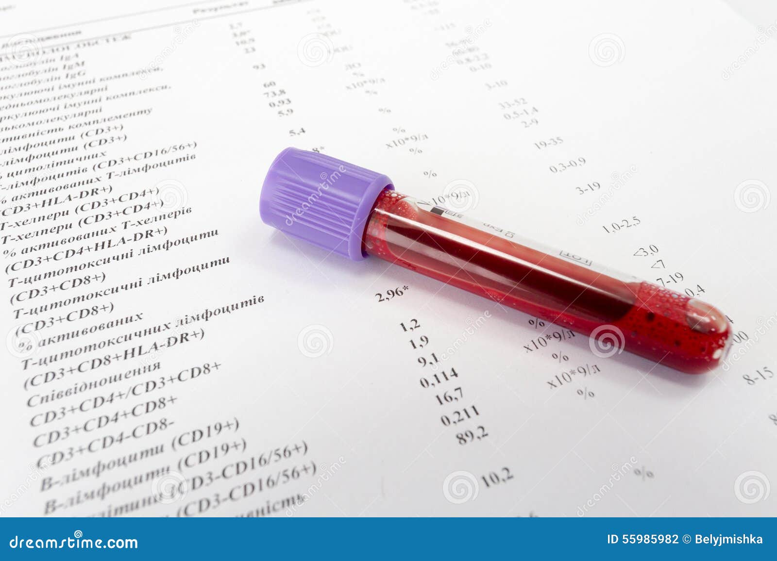 Какая ты кровь тест. Пробирки с кровью. Клинический анализ крови пробирка. Пробирки для забора крови подписанные. Красная пробирка для забора крови.