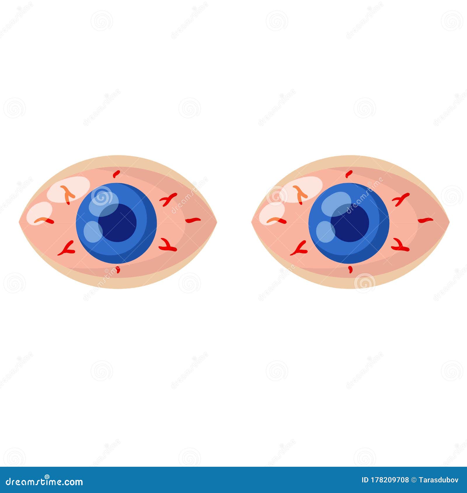 Red Eyeball Stock Illustrations – 4,471 Red Eyeball Stock