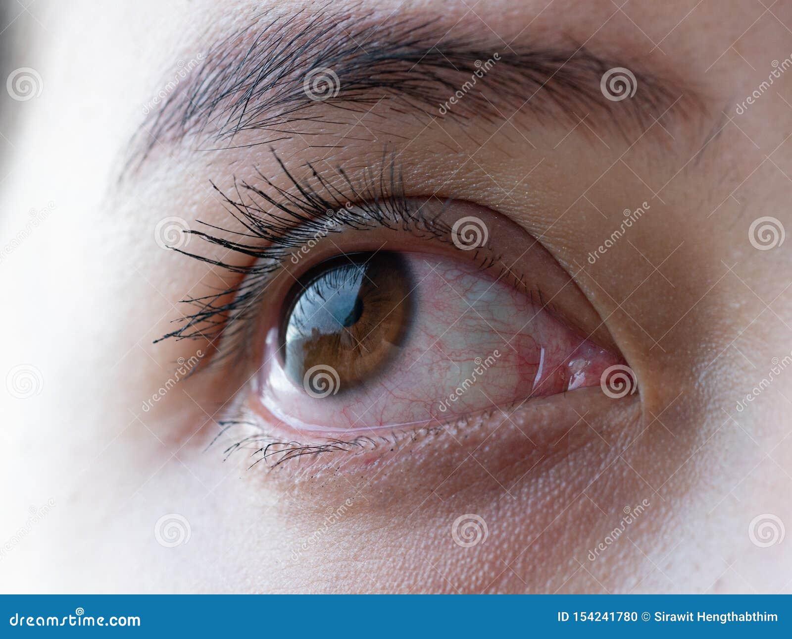 Red Eye of Woman , Conjunctivitis Eye or after Cry Stock Photo Image