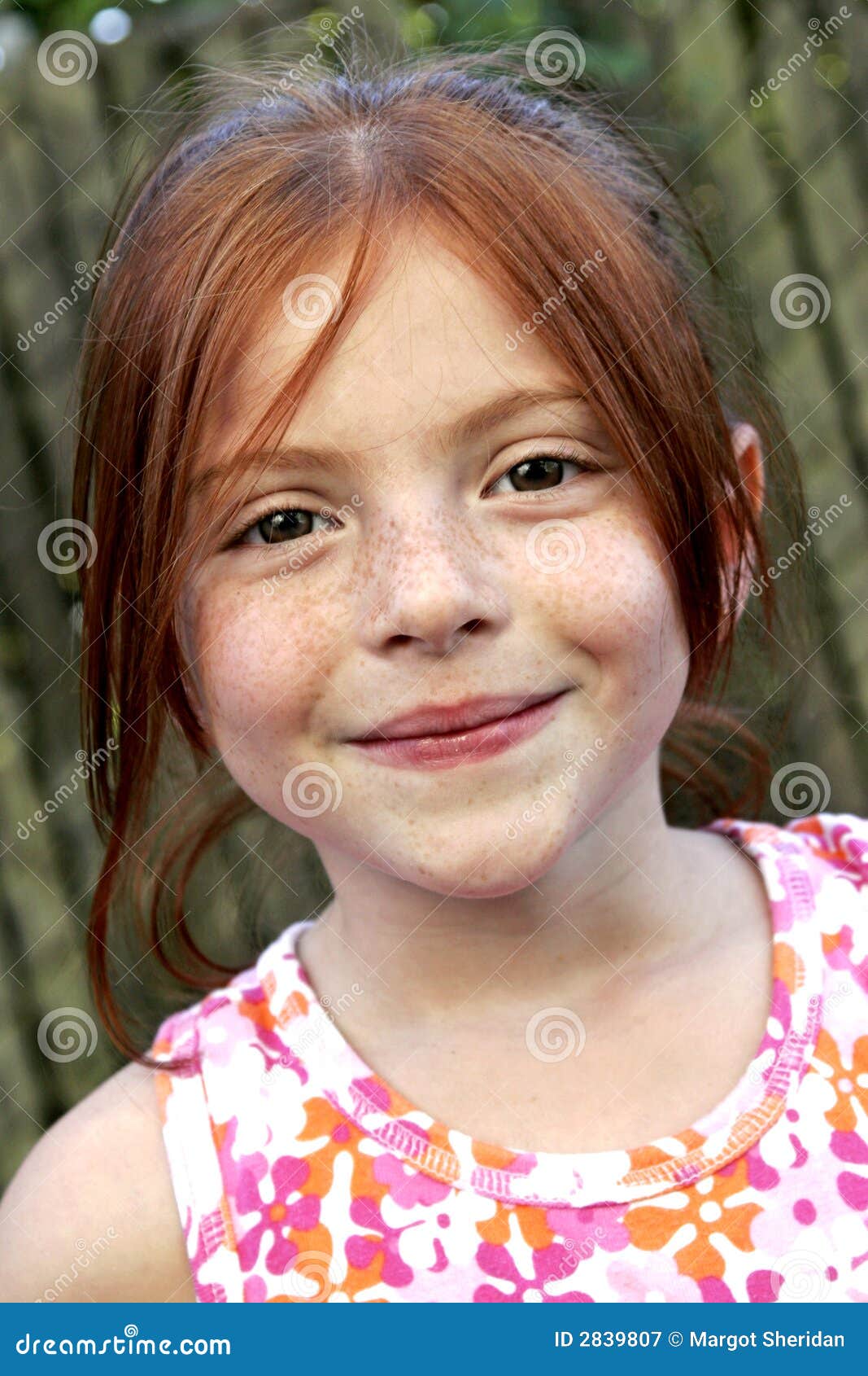red hair and freckles