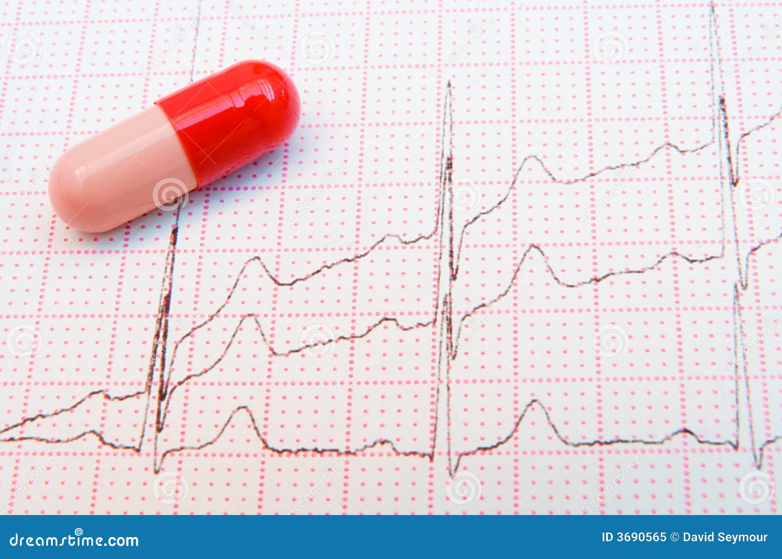 cardiograph of the heart cardiograph of the heart