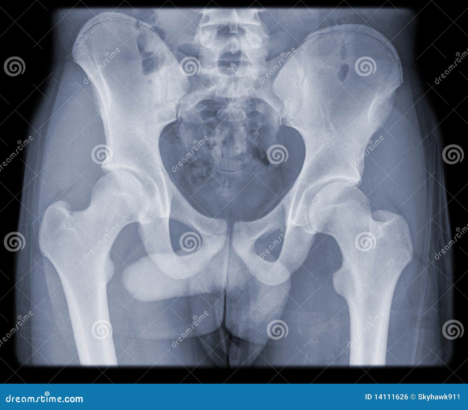 Regular Hip And Pelvis Of Young Man Royalty Free Stock Image - Image