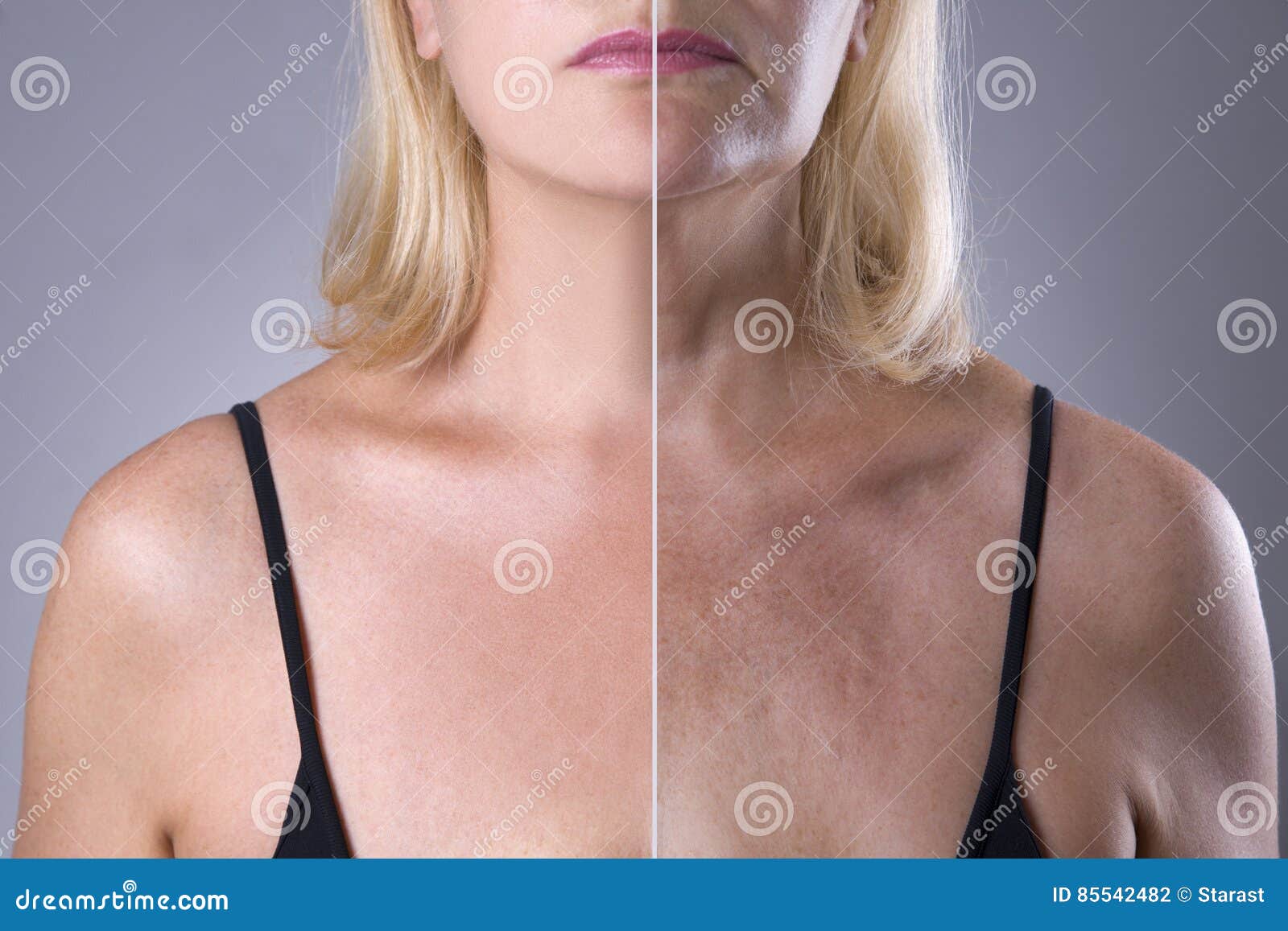 rejuvenation woman`s skin, before after anti aging concept, wrinkle treatment, facelift and plastic surgery