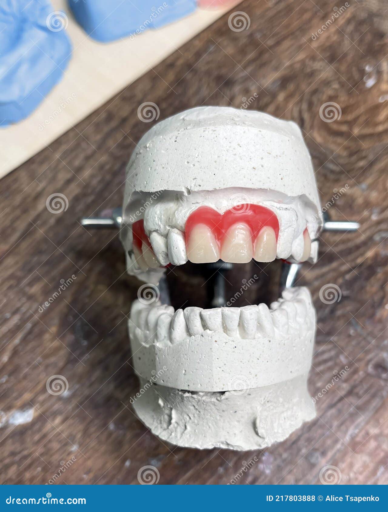 Removable Denture in the Dental Laboratory. Stock Photo Image of food