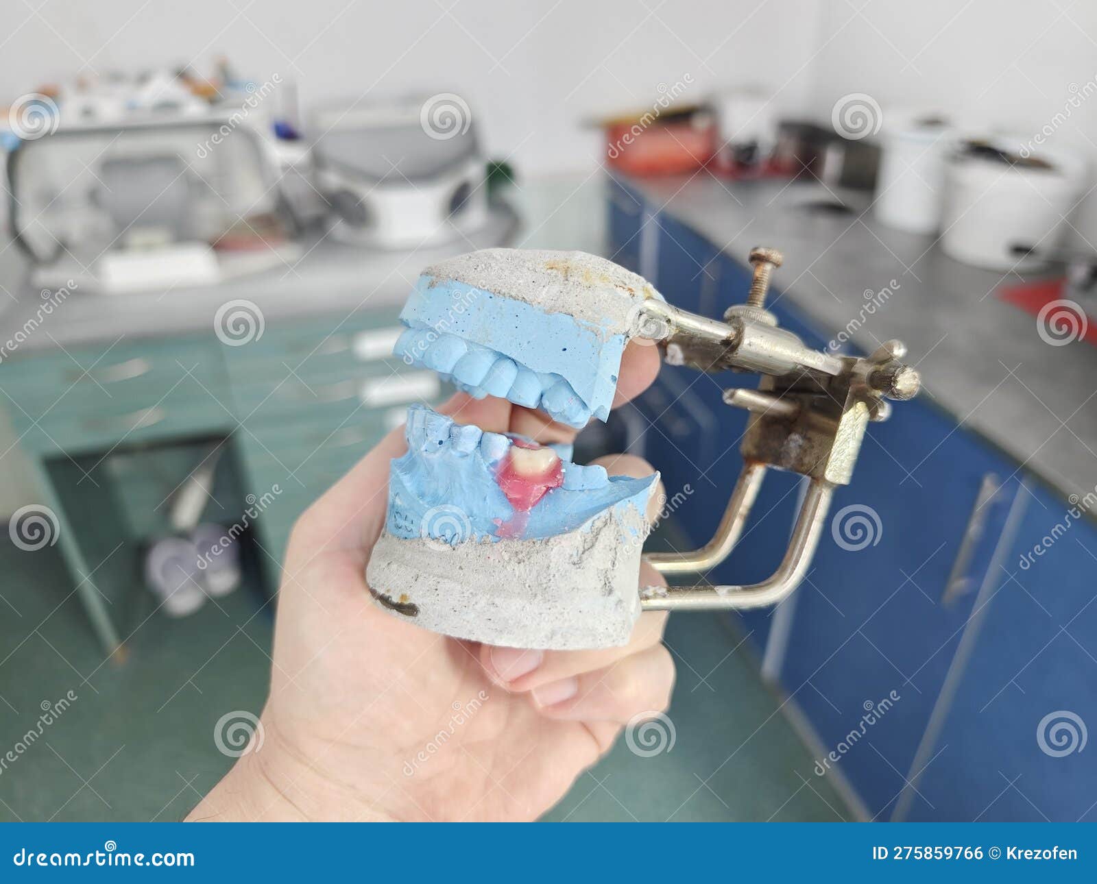 Removable Dentures for the Patient are Made in a Dental Laboratory