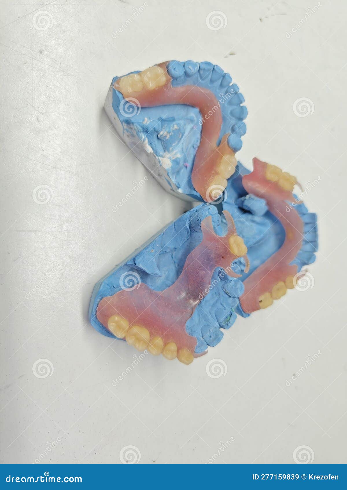 Removable Dentures for the Patient are Made in a Dental Laboratory