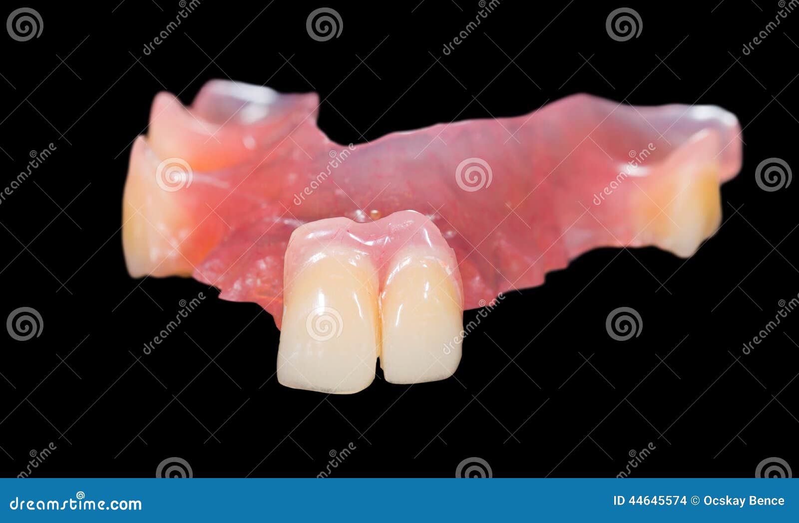 Removable prosthesis stock photo. Image of anatomy, partial 44645574