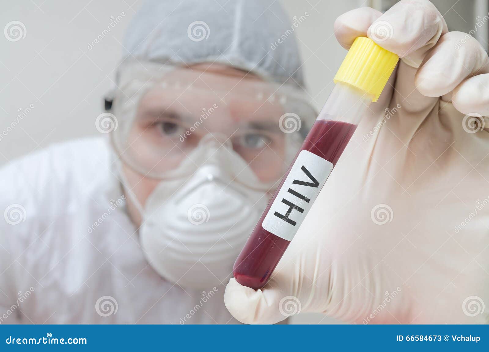 Researcher Holds Test Tube with Blood for Analyzing HIV Stock Image
