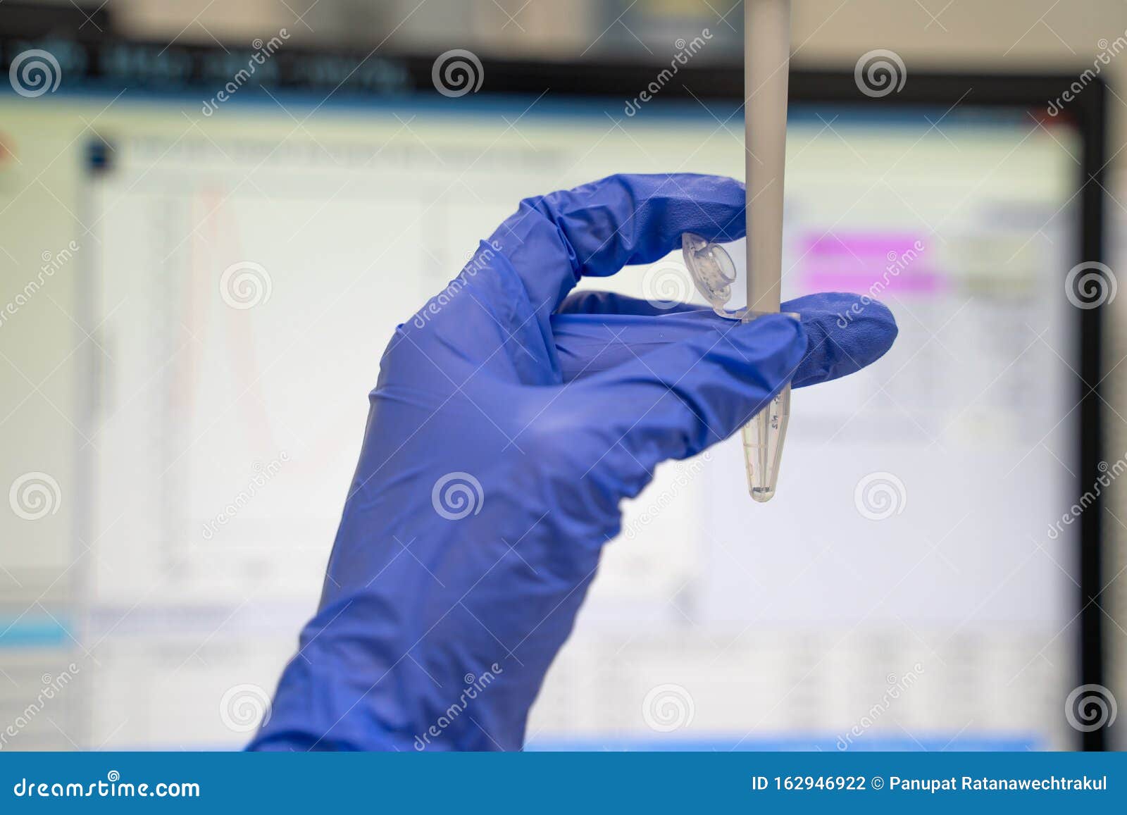 the researcher measuring the sample was aspirated using vertically pipette and does not touch the sides of the microtube. before