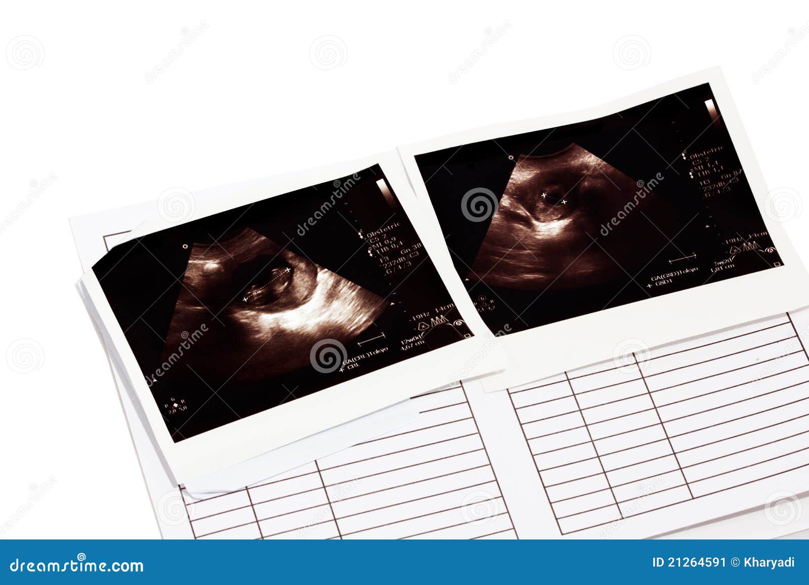 Resultados De Exploracion De Usg Imagen De Archivo Imagen De