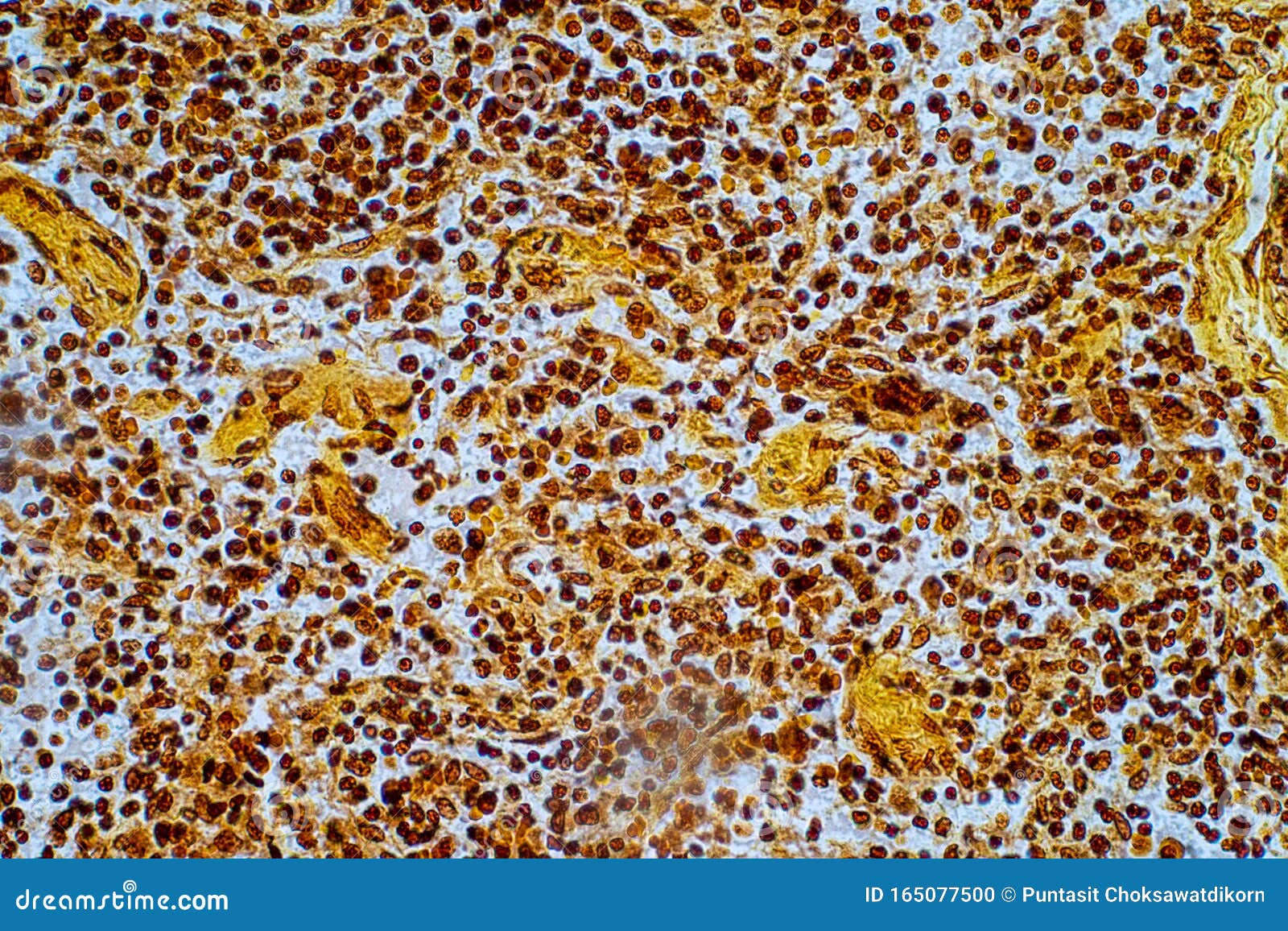 reticular cell is a type of fibroblast. they are found in many tissues including the spleen, lymph nodes and lymph nodules