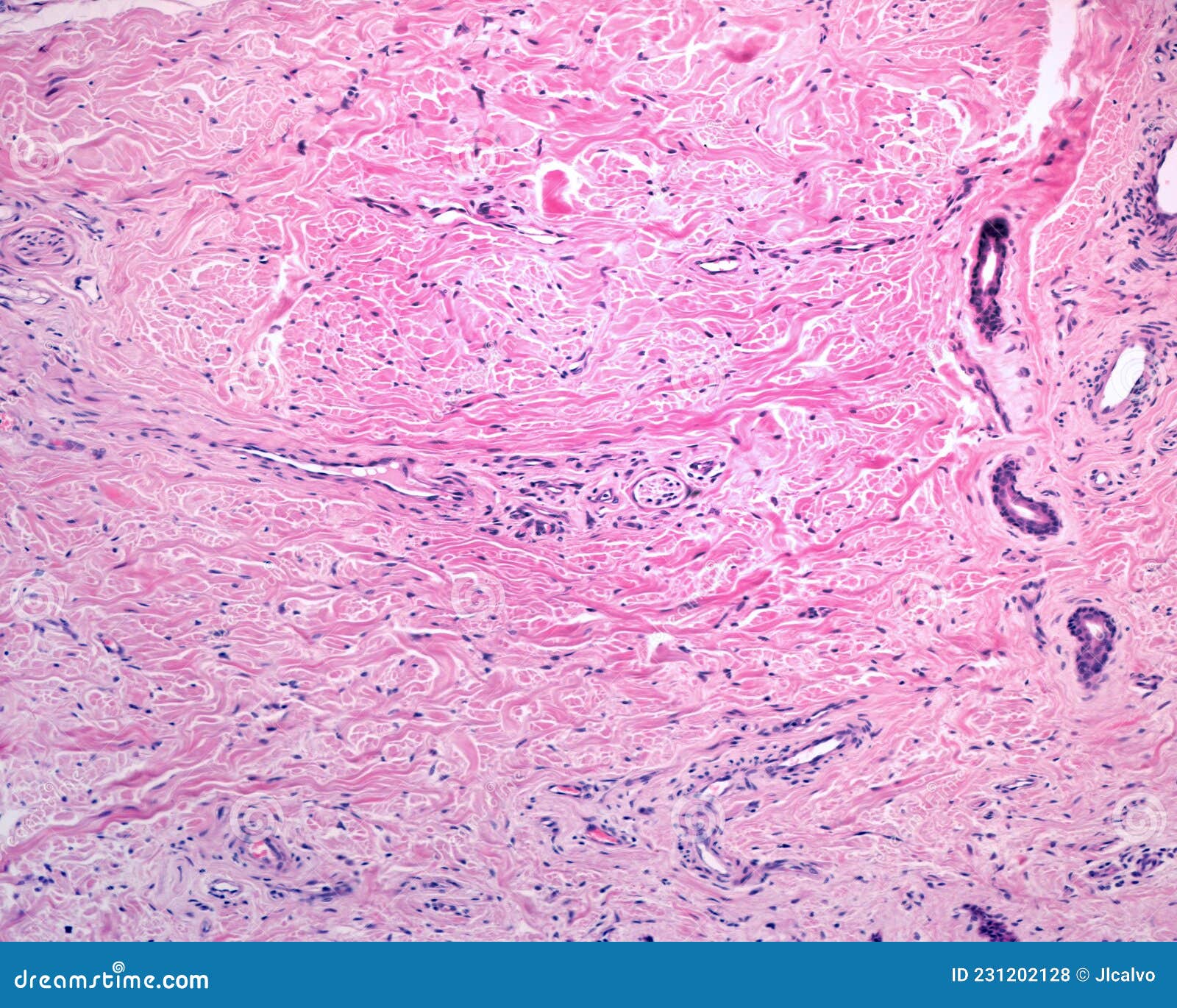 reticular dermis. human skin