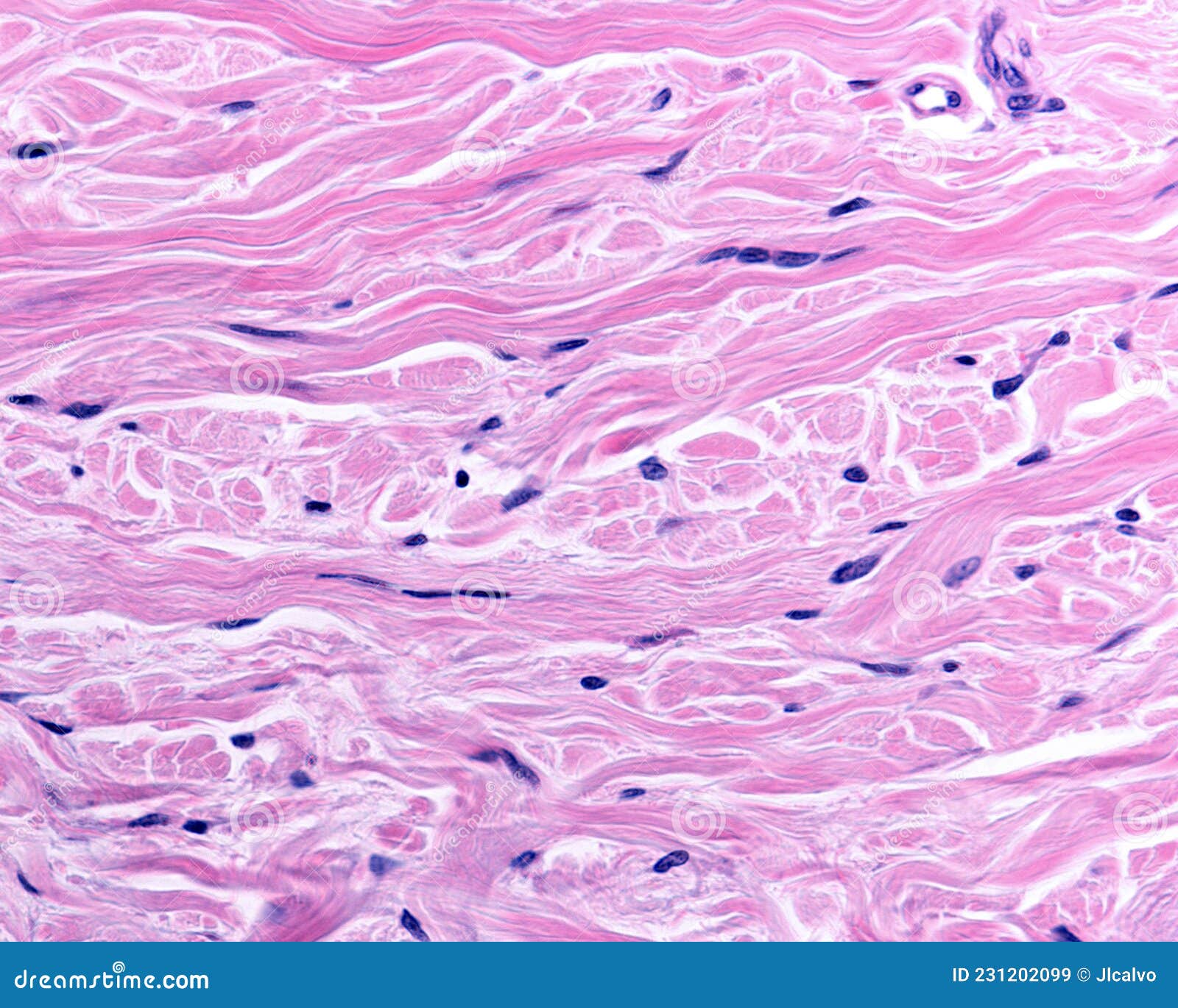 reticular dermis. human skin