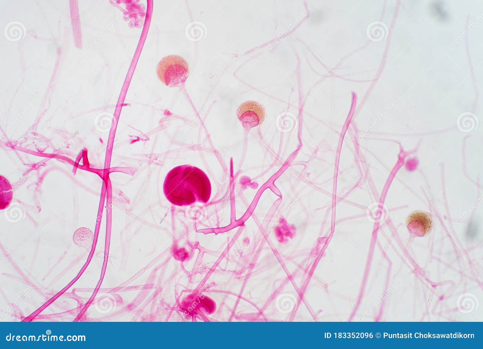 https://thumbs.dreamstime.com/z/rhizopus-bread-mold-under-microscope-genus-common-saprophytic-fungi-183352096.jpg
