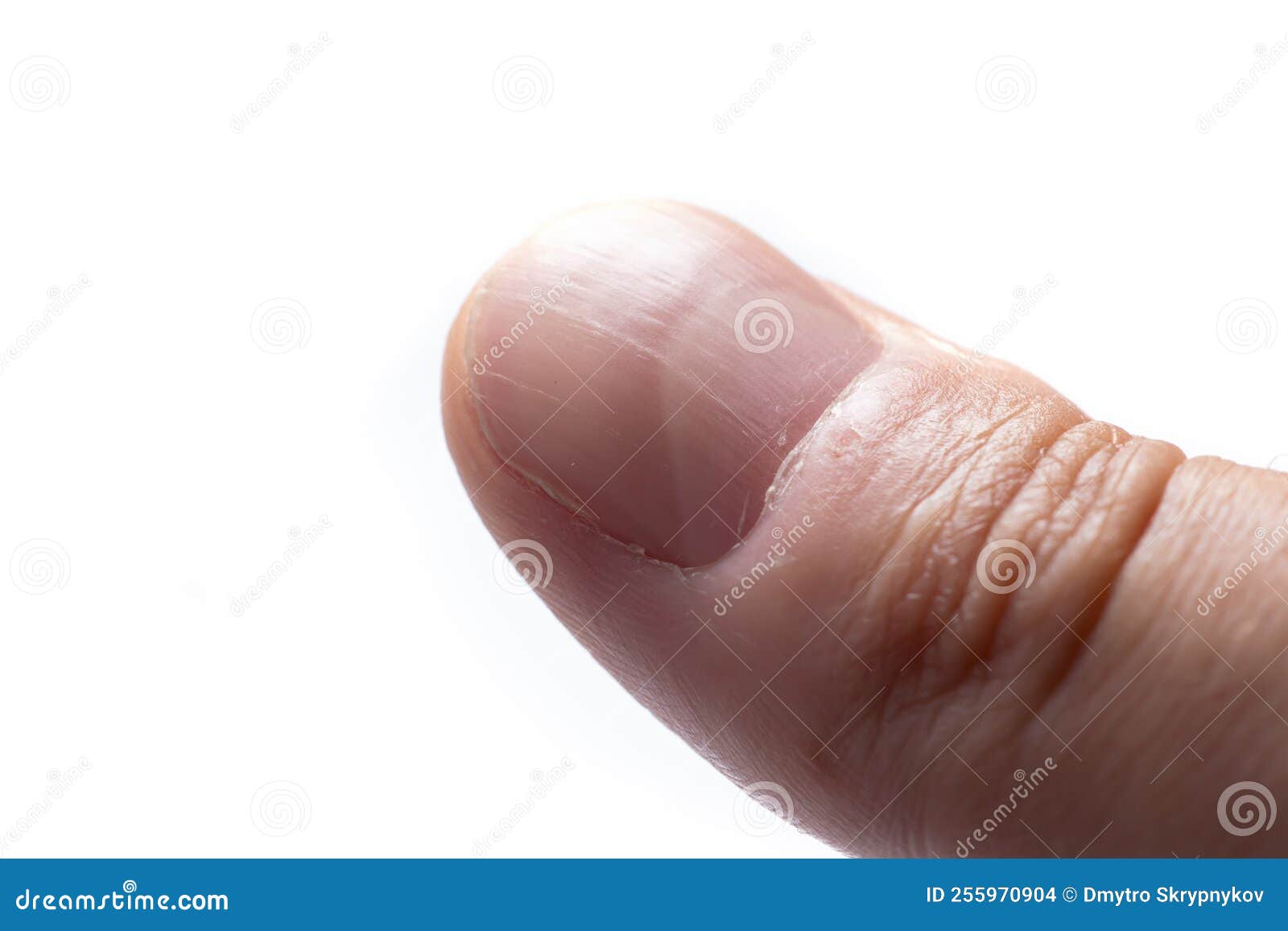 Long nails on right hand with no nail polish | My super long… | Flickr