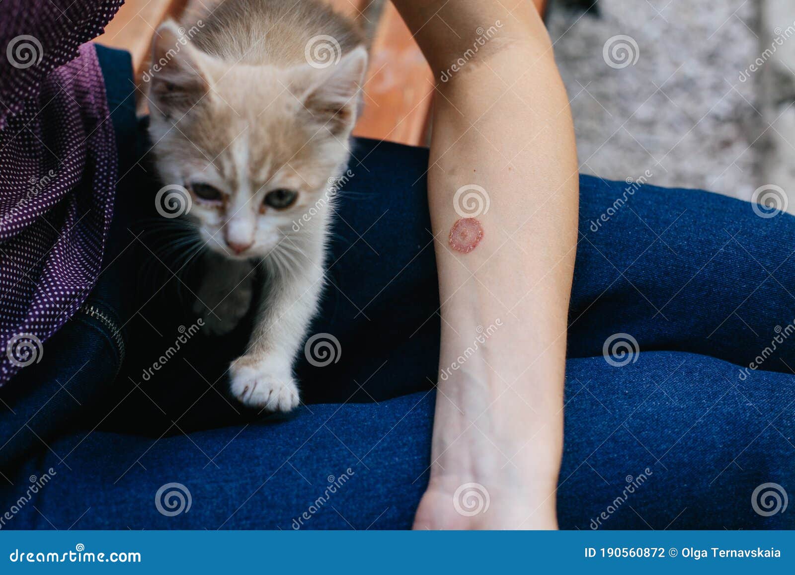 ringworm arm hand cat disease skin problem ringworm arm hand cat disease 190560872