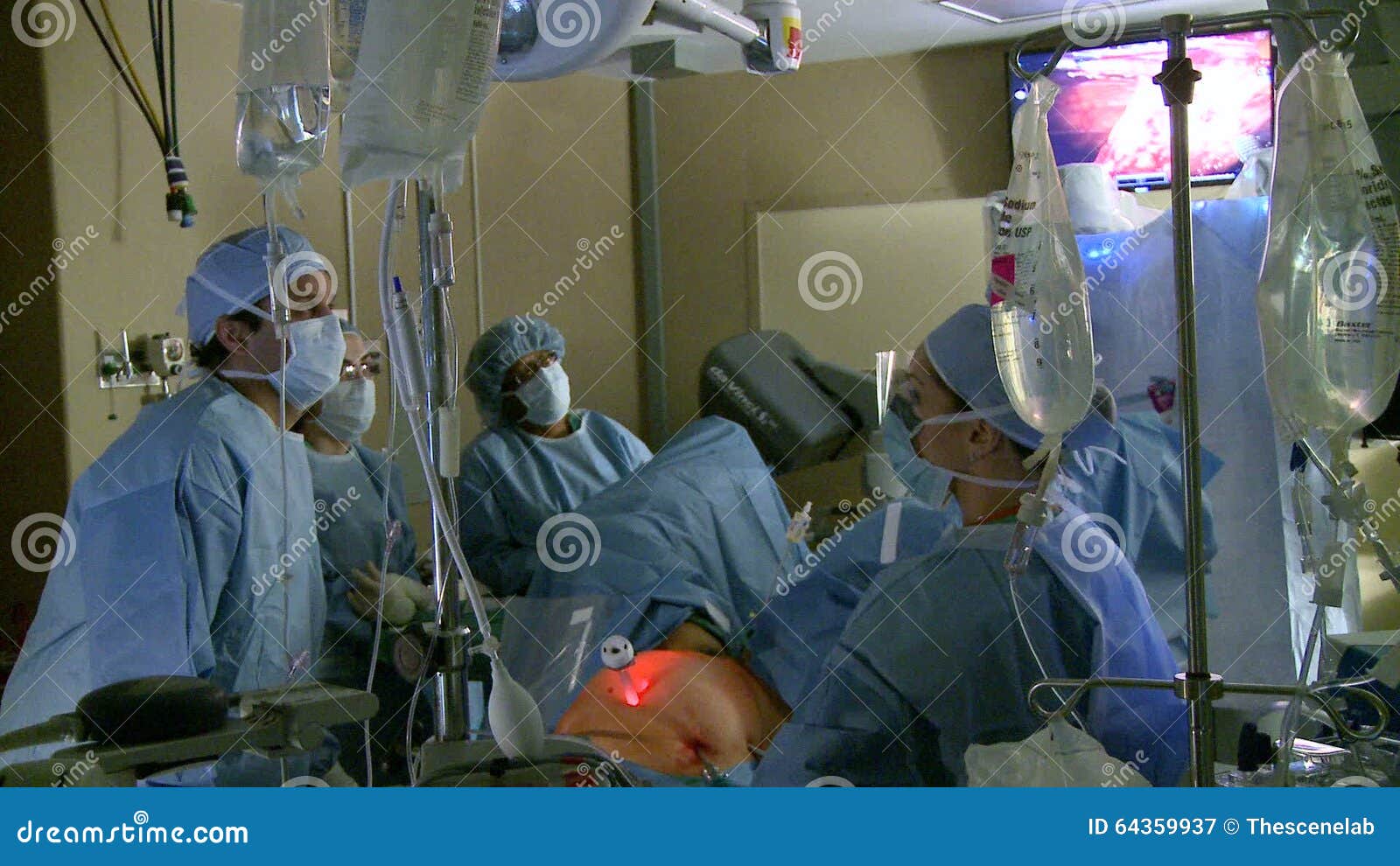 Robotic Hysterectomy Surgery (12 of 15) Stock Video Video of ovary