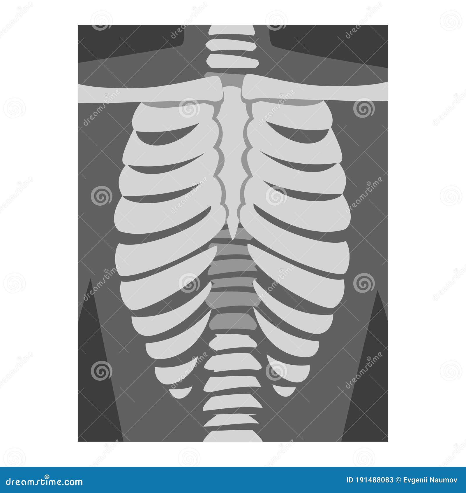 roentgenograph of spine and back bone  image