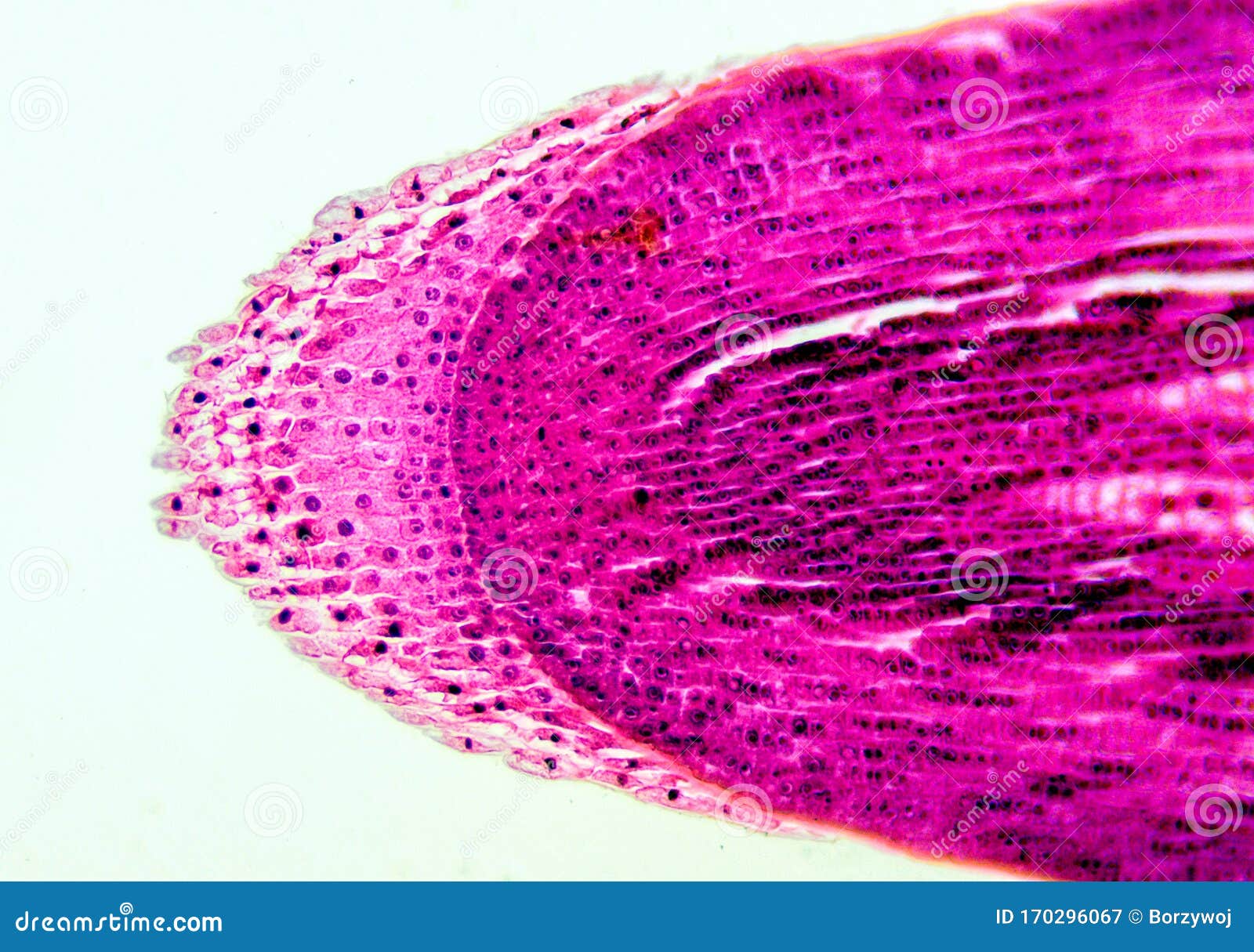 root apex - microscopic view