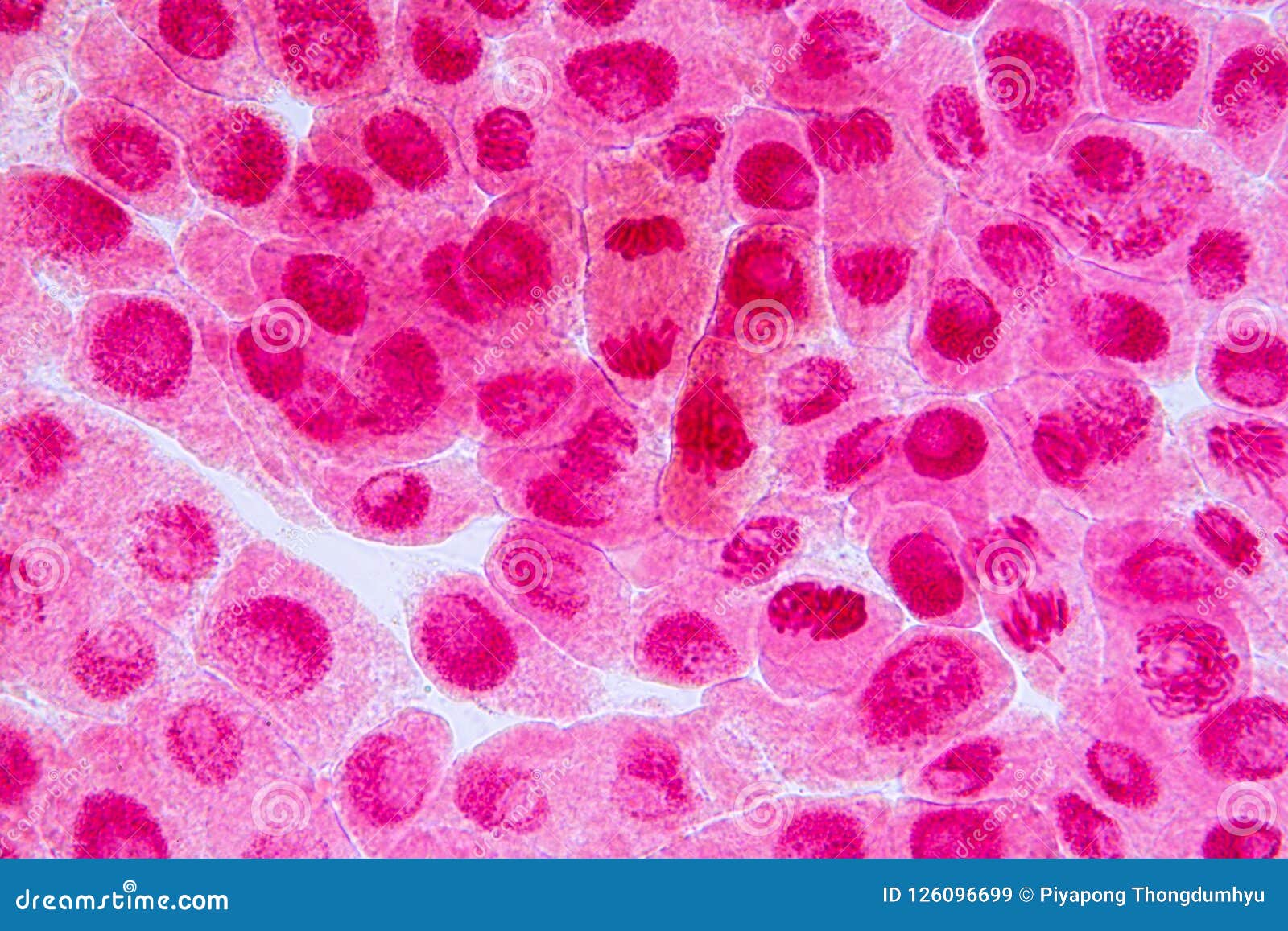 Root Tip Of Onion And Mitosis Cell In The Root Tip Of Onion. Stock