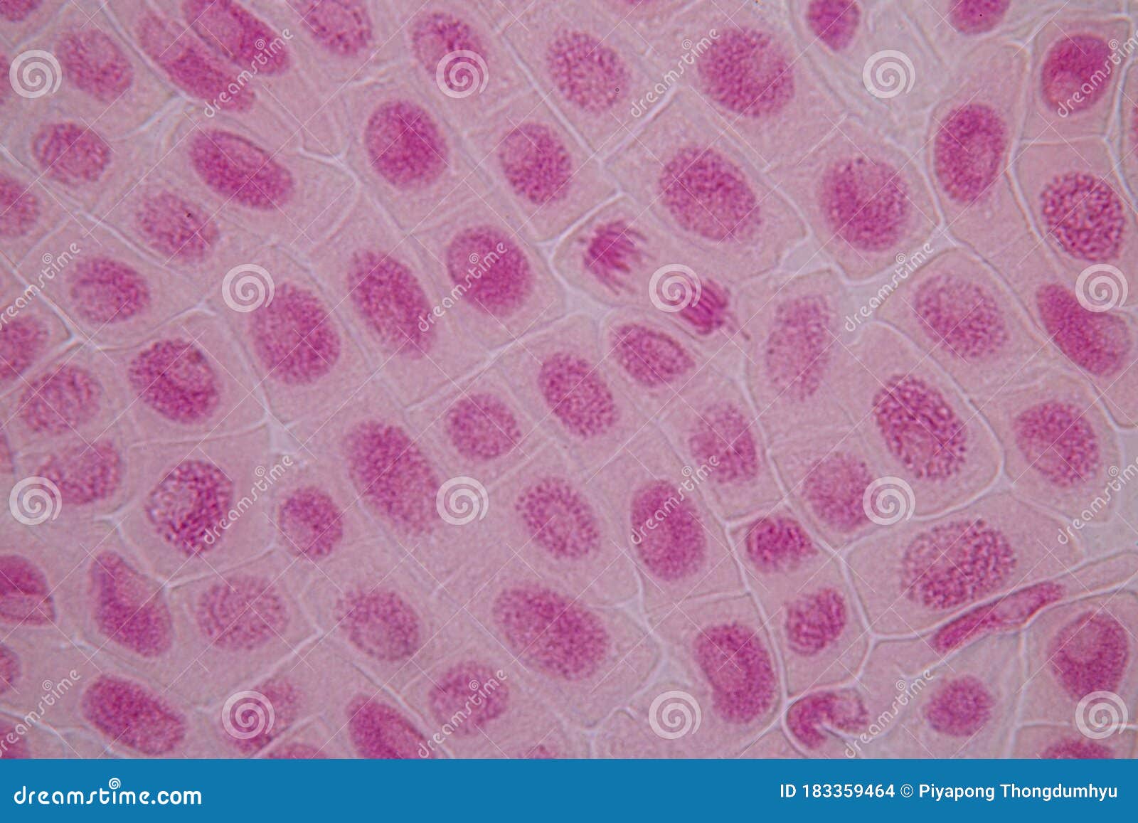 Mitosis Cell in the Root Tip of Onion Under a Microscope. Stock Photo