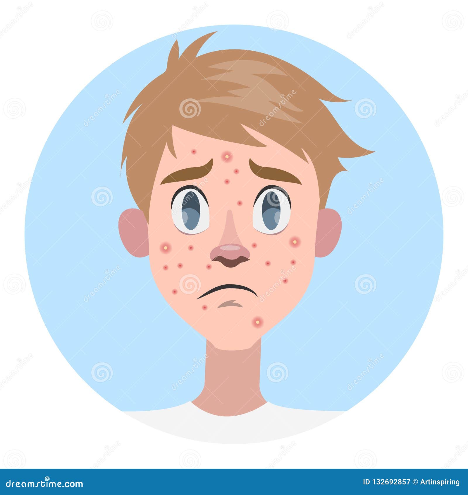 Sad Man With Acne  On The Face Stock Vector Illustration 