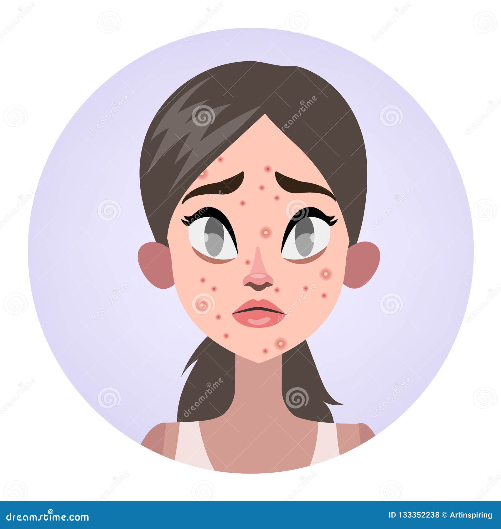  Acne  Cartoons  Illustrations Vector Stock Images 3983 