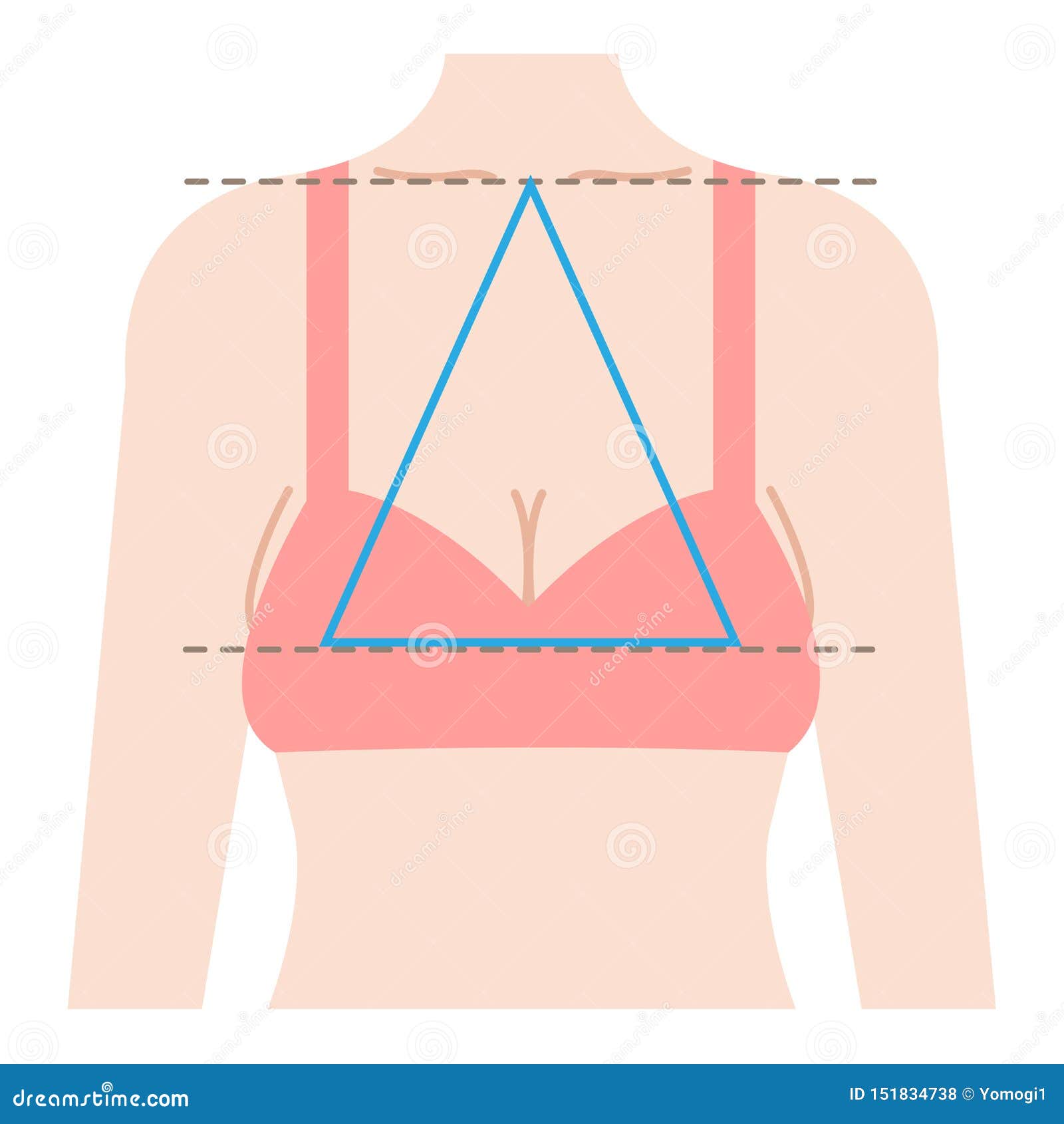 Sagging Breast Shape is Isosceles Triangle Connecting Three Points