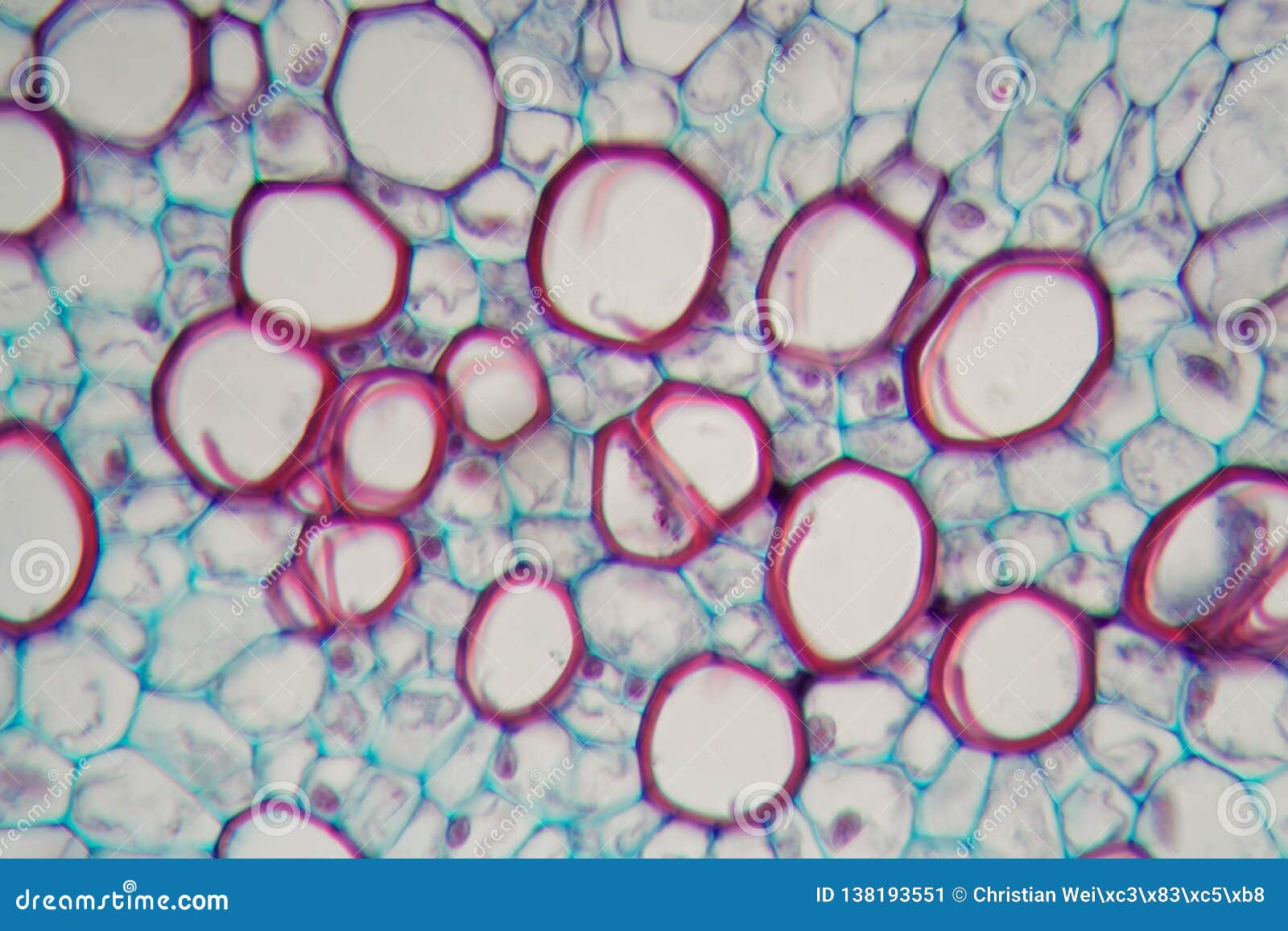 sambucus stem with parenchyma cells under the microscope