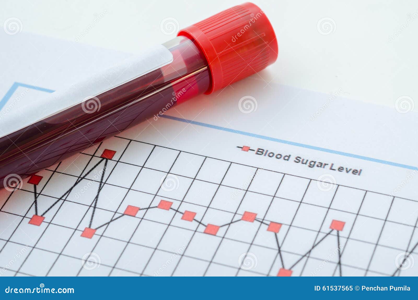 Blood Collection Tubes And Tests Chart