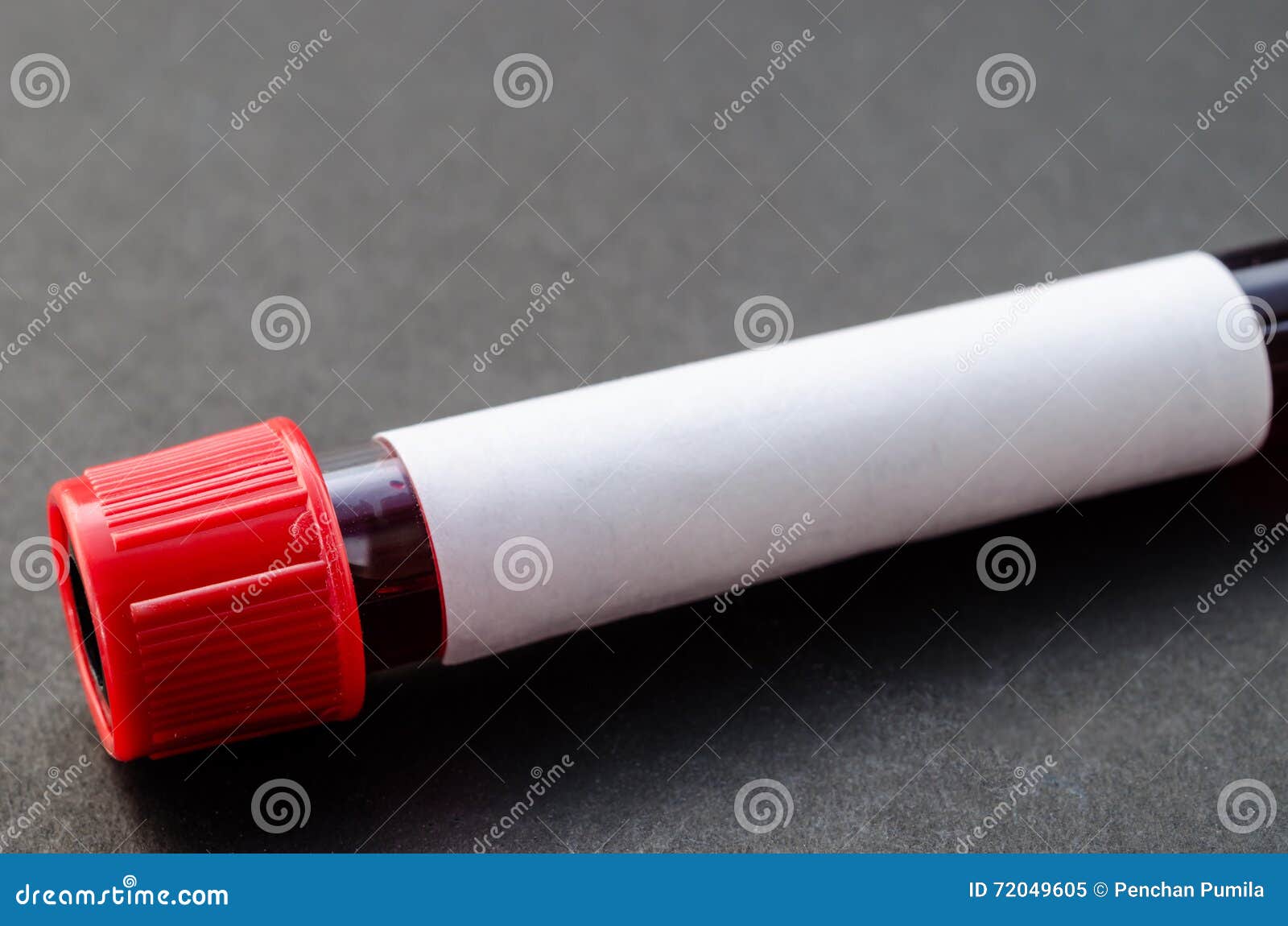 Sample Blood in Vacuum Tubes Stock Image Image of bloodwork, health