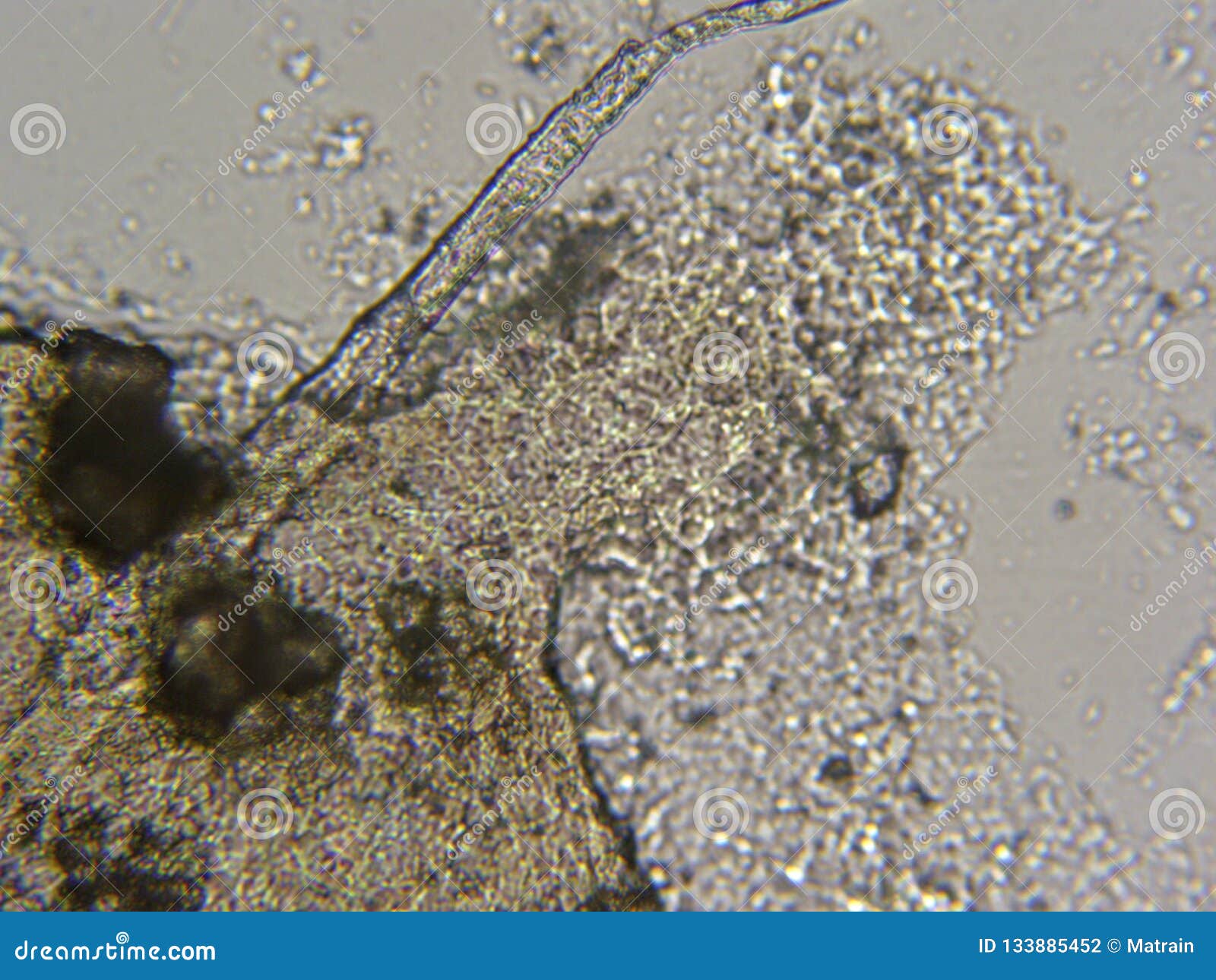 Mildew from Shower Curtain in Microscope Stock Photo Image of