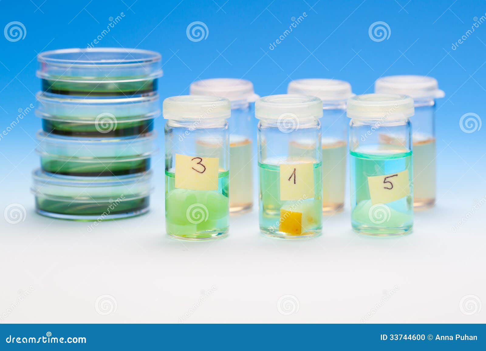 samples in plastic vials for microscopy and biopsy tissue.