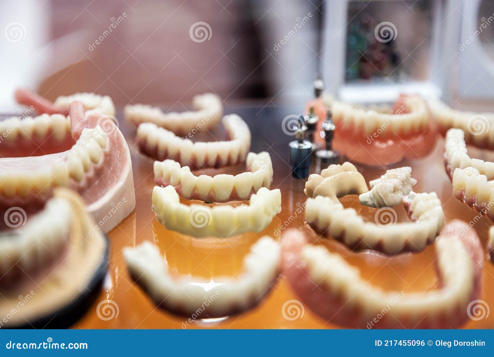 Samples with Porcelain Teeth and Dental Prosthesis Stock Photo Image