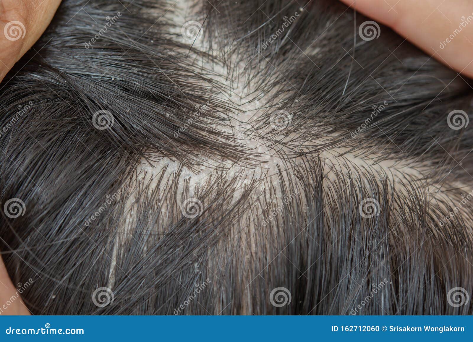 scalp and dandruff skin problems and itching