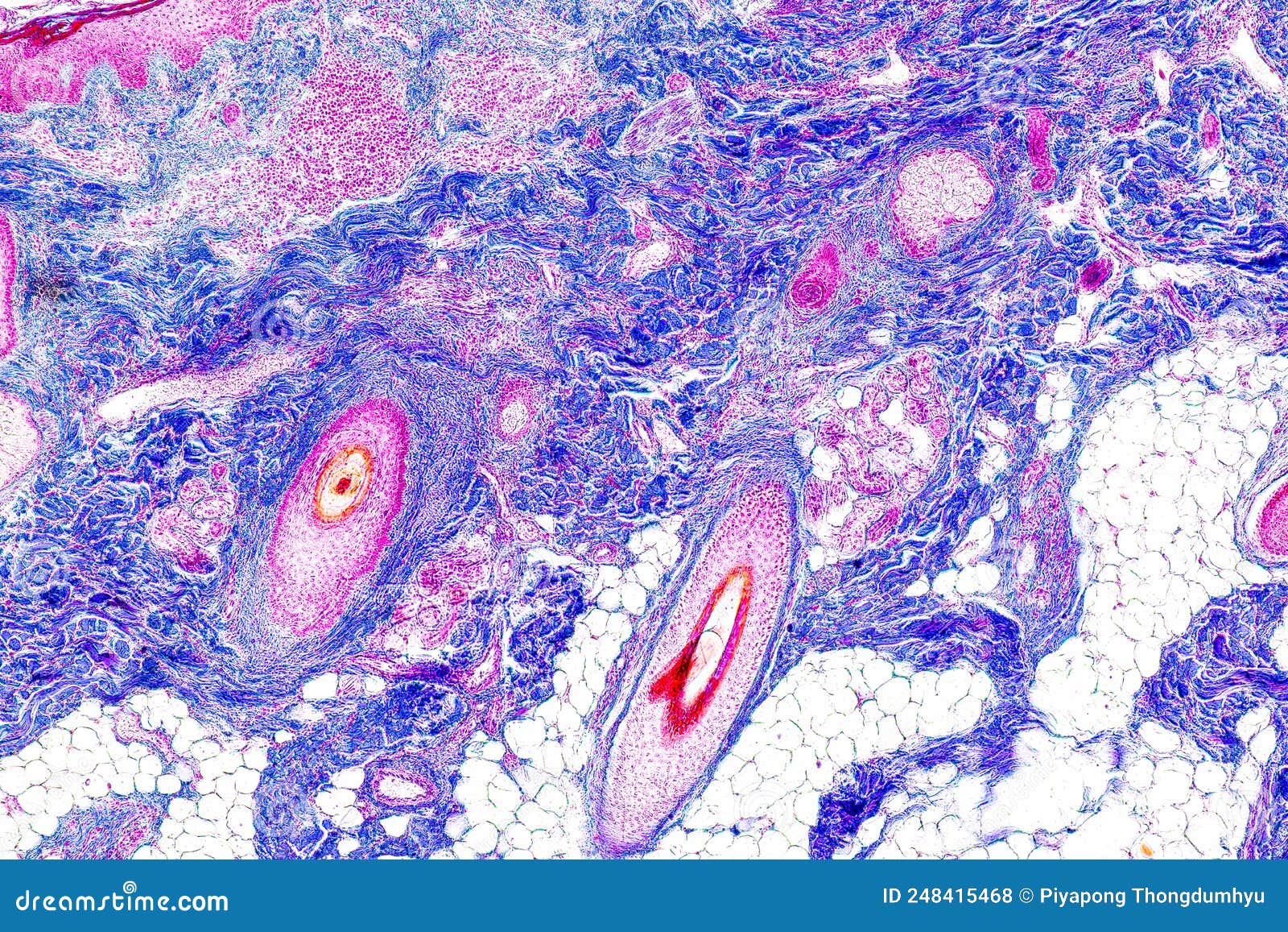 Scalp and Hair Follicles of Human Under the Microscope. Stock Photo